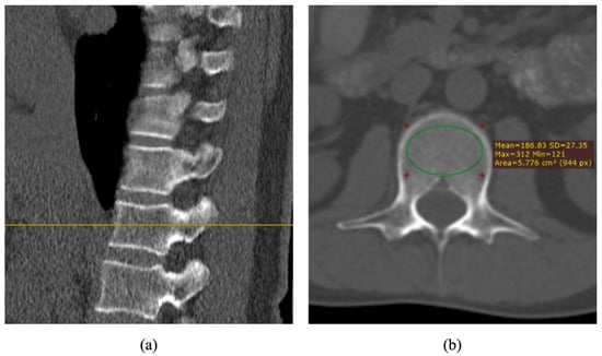 https://www.mdpi.com/healthcare/healthcare-11-00556/article_deploy/html/images/healthcare-11-00556-g001-550.jpg