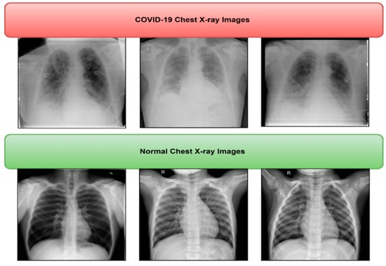 Healthcare | Free Full-Text | Computer-Aided Diagnosis of COVID-19 from ...