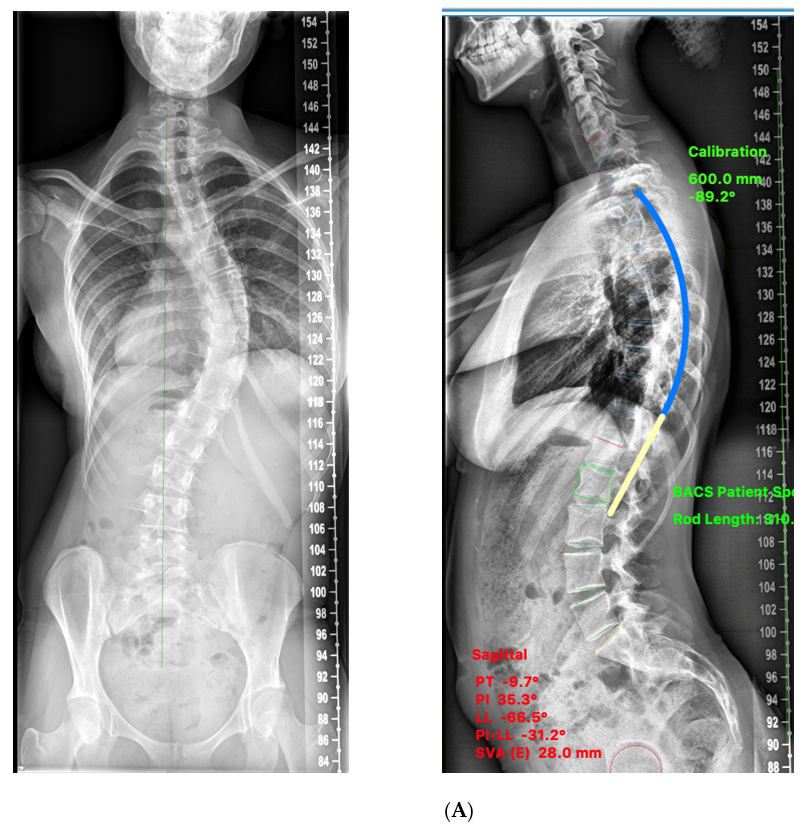 Healthcare 11 00980 g005a Healthcare 11 00980 g005a