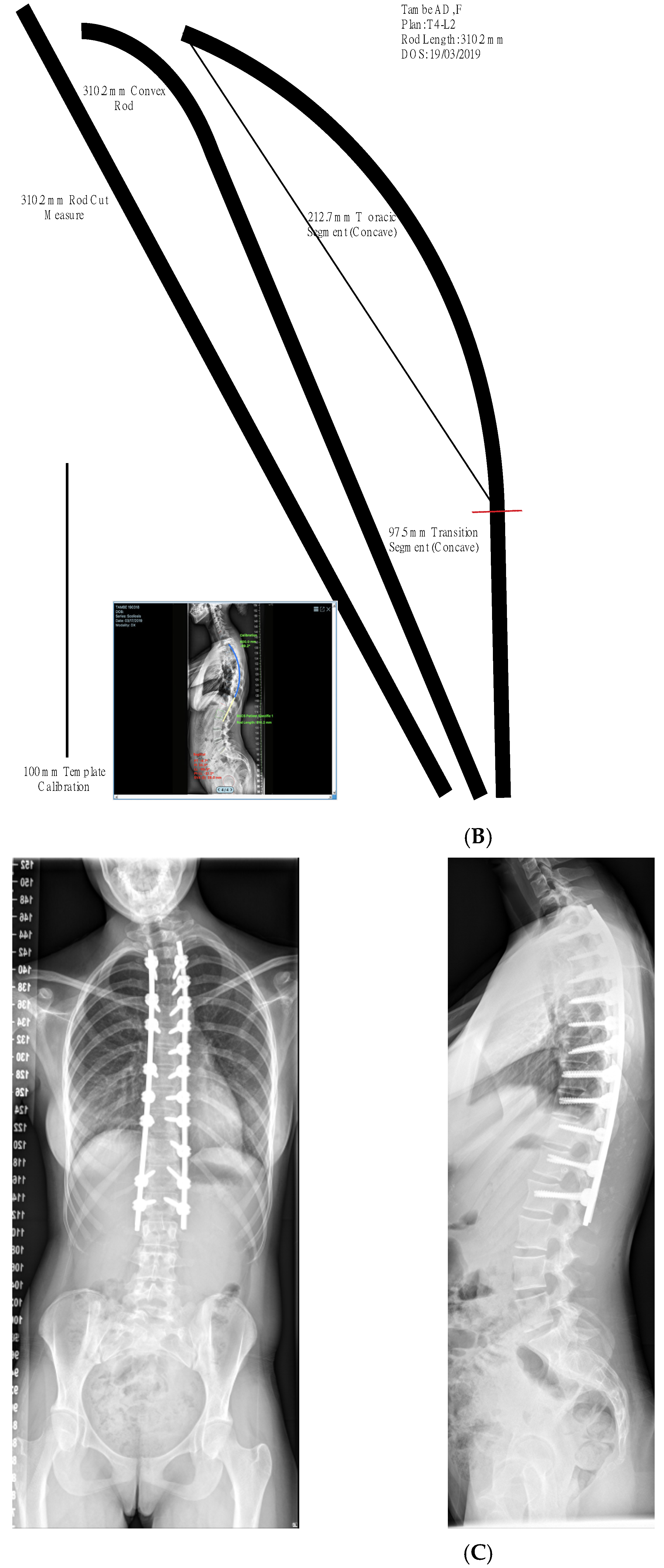 Healthcare 11 00980 g005b Healthcare 11 00980 g005b