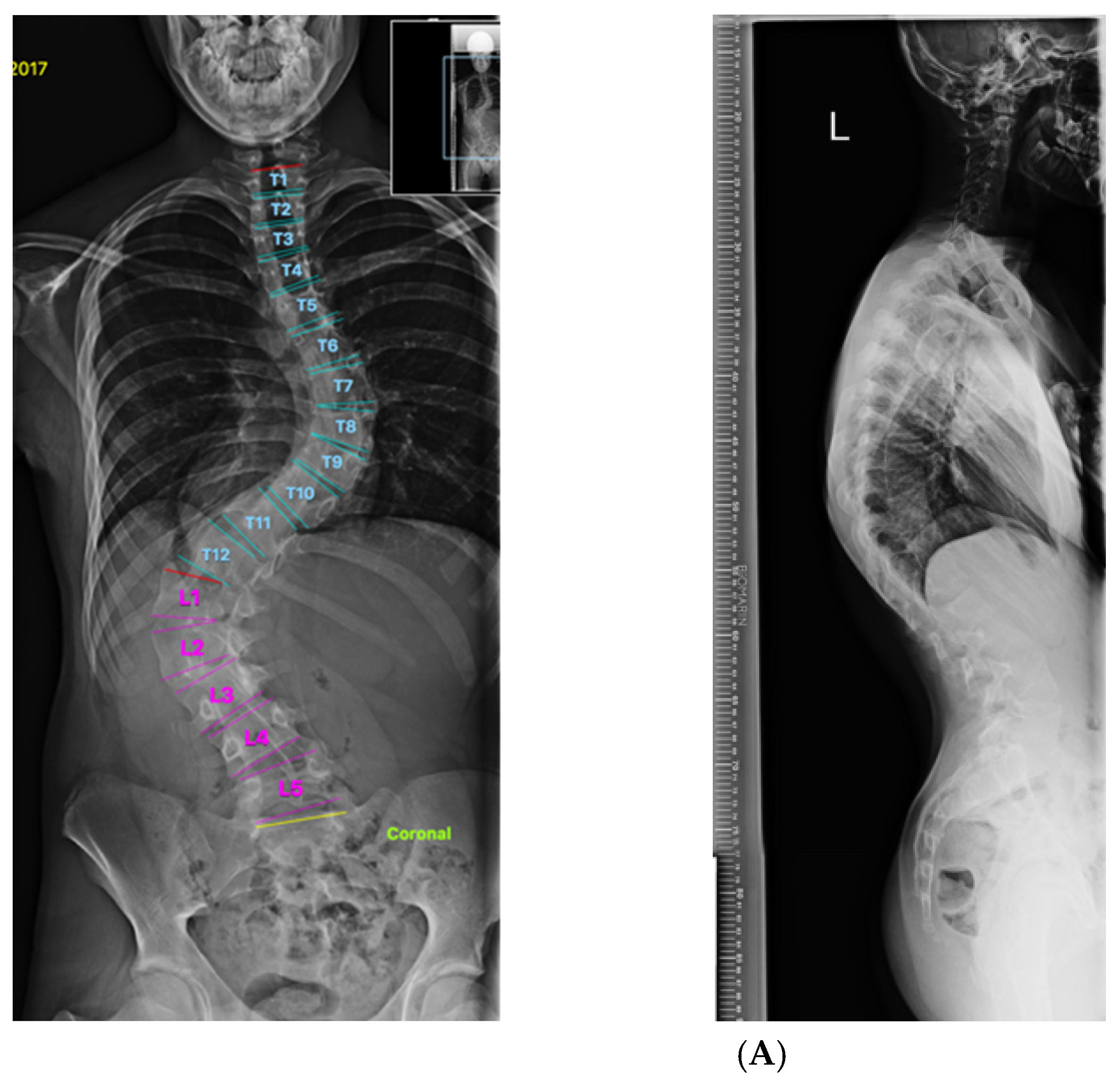 Healthcare 11 00980 g007a Healthcare 11 00980 g007a