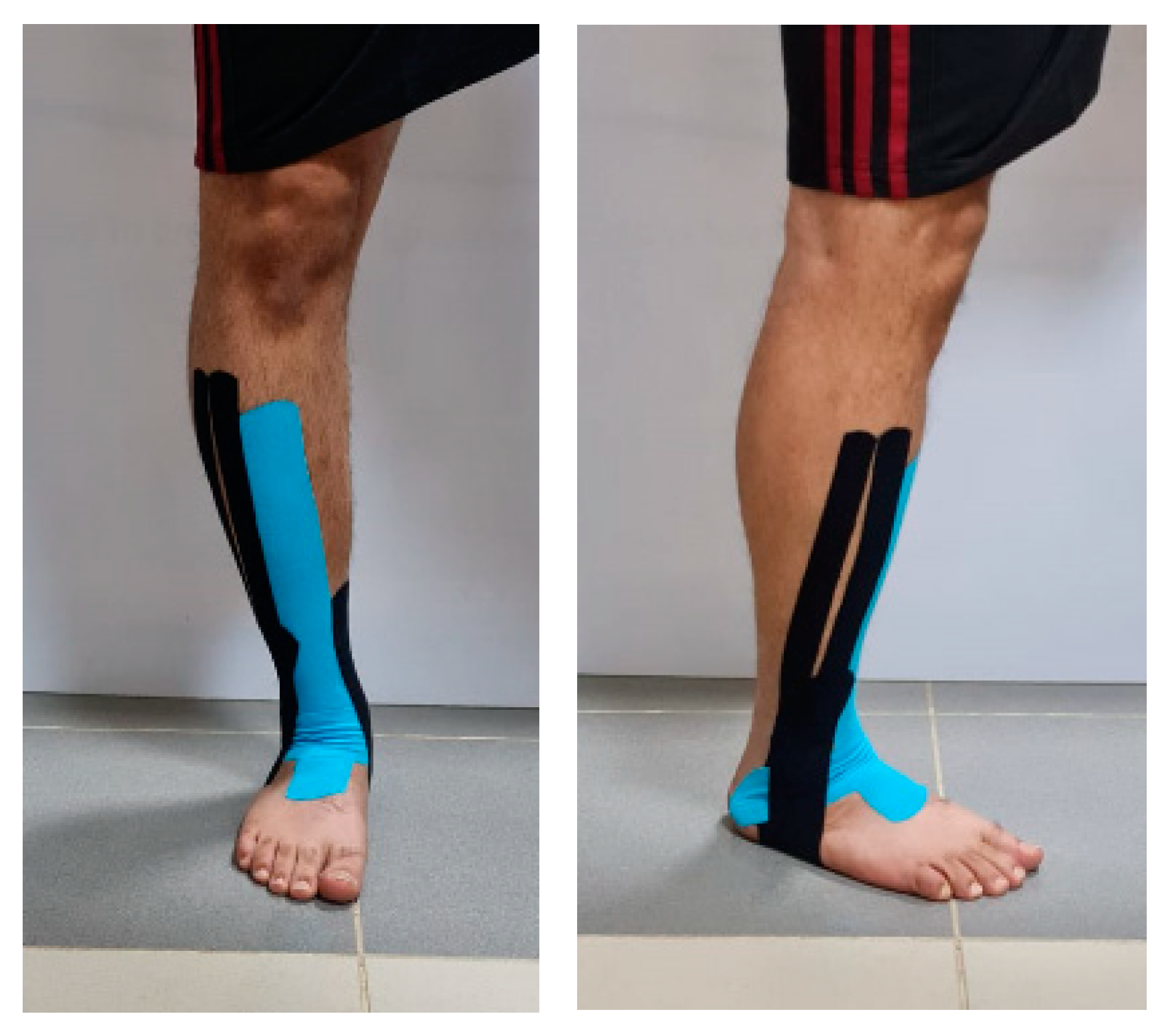 Healthcare | Free Full-Text | The Effect of Kinesio Taping on Balance and  Dynamic Stability in College-Age Recreational Runners with Ankle Instability