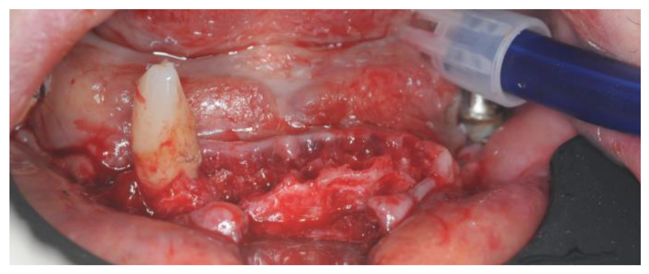 Healthcare 12 00332 g011