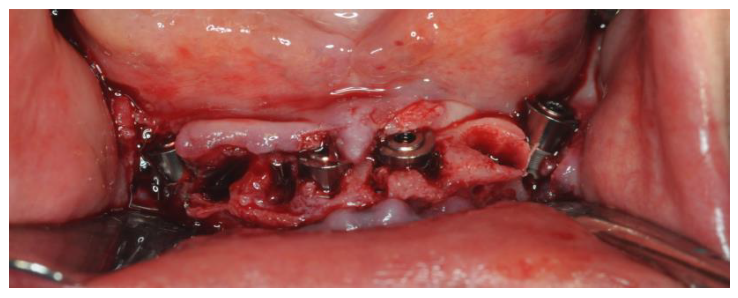 Healthcare 12 00332 g014