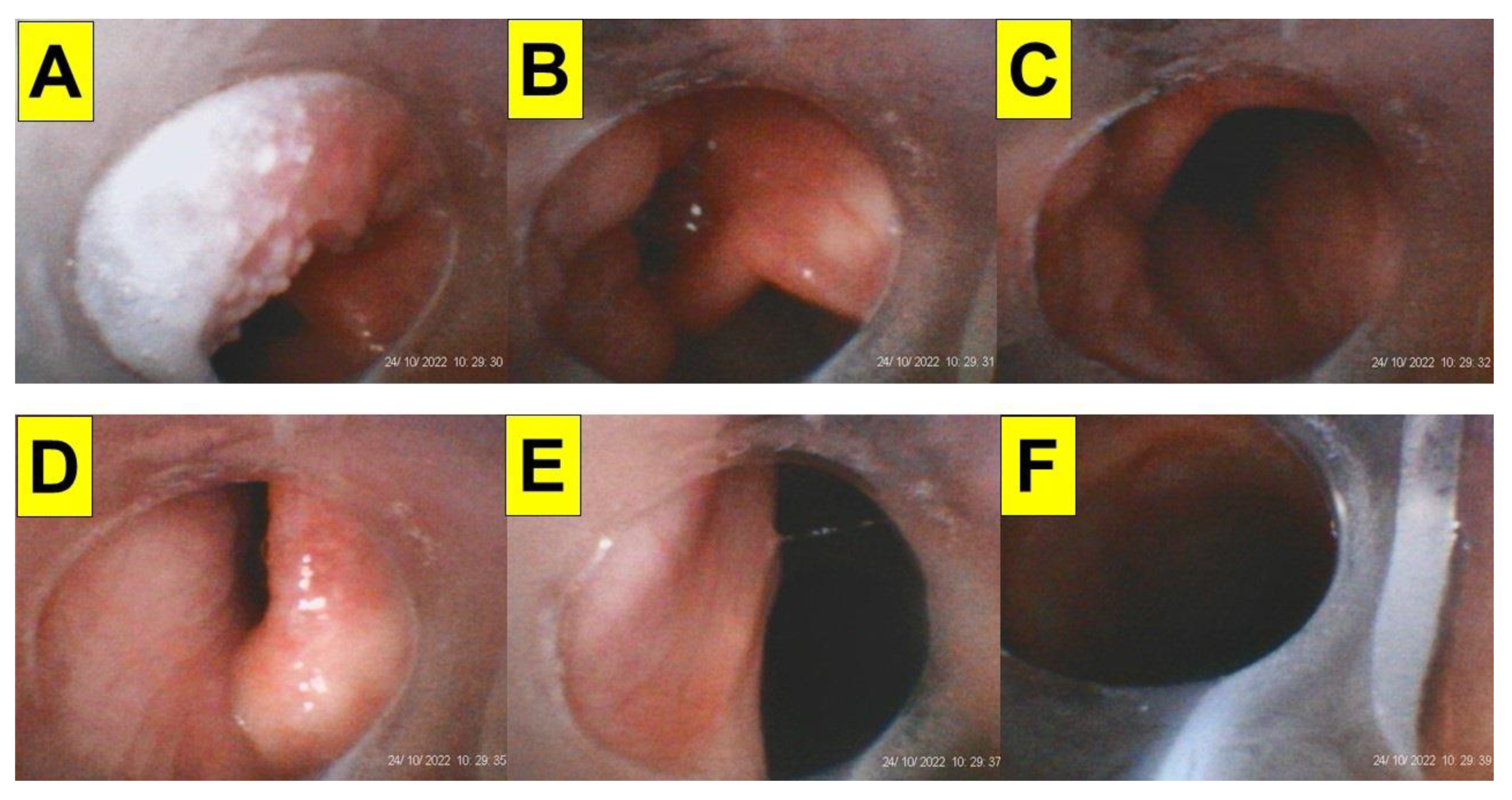 Healthcare 12 01404 g006 Healthcare 12 01404 g006