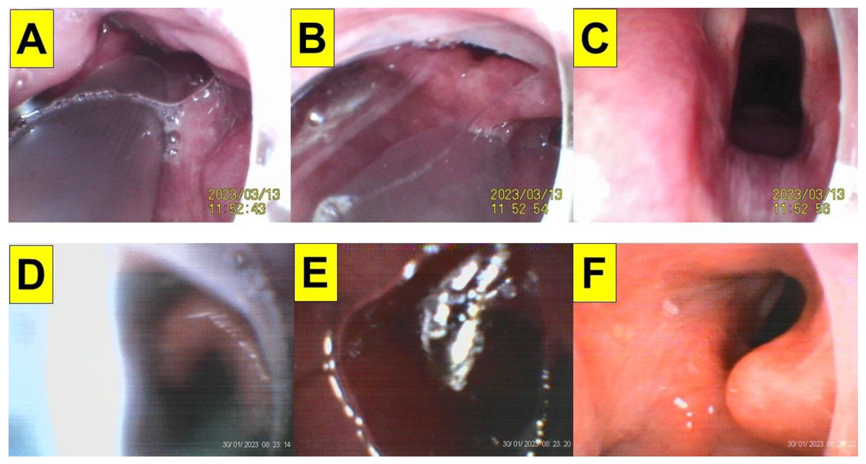 Healthcare 12 01404 g007 Healthcare 12 01404 g007