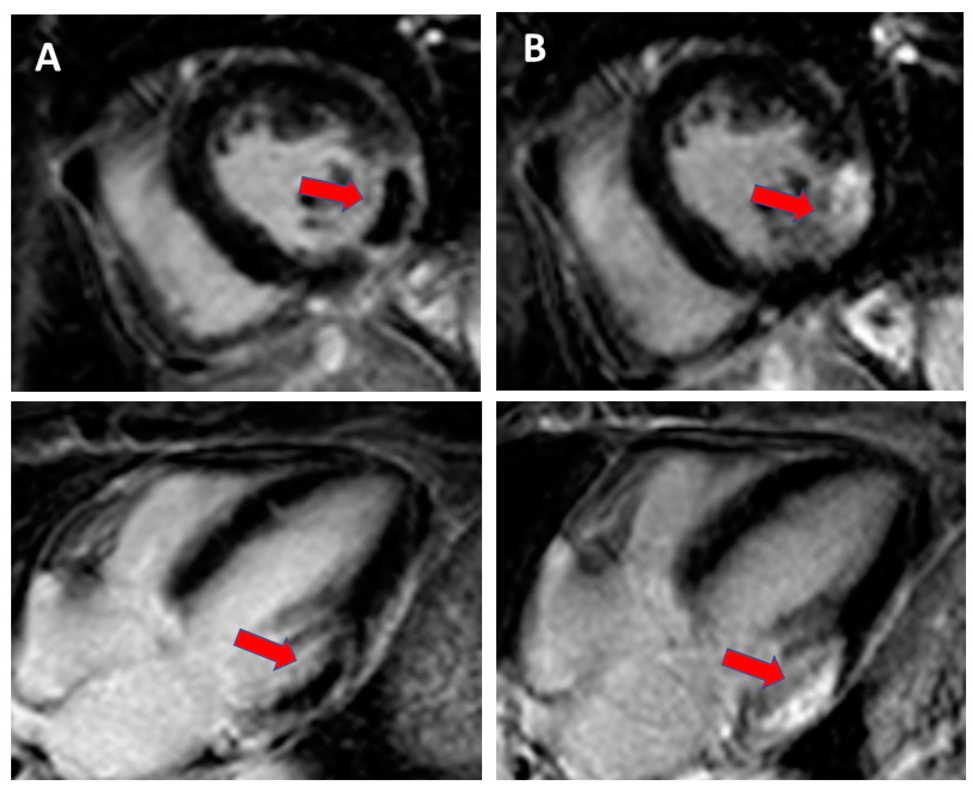 Hearts 01 00017 g003