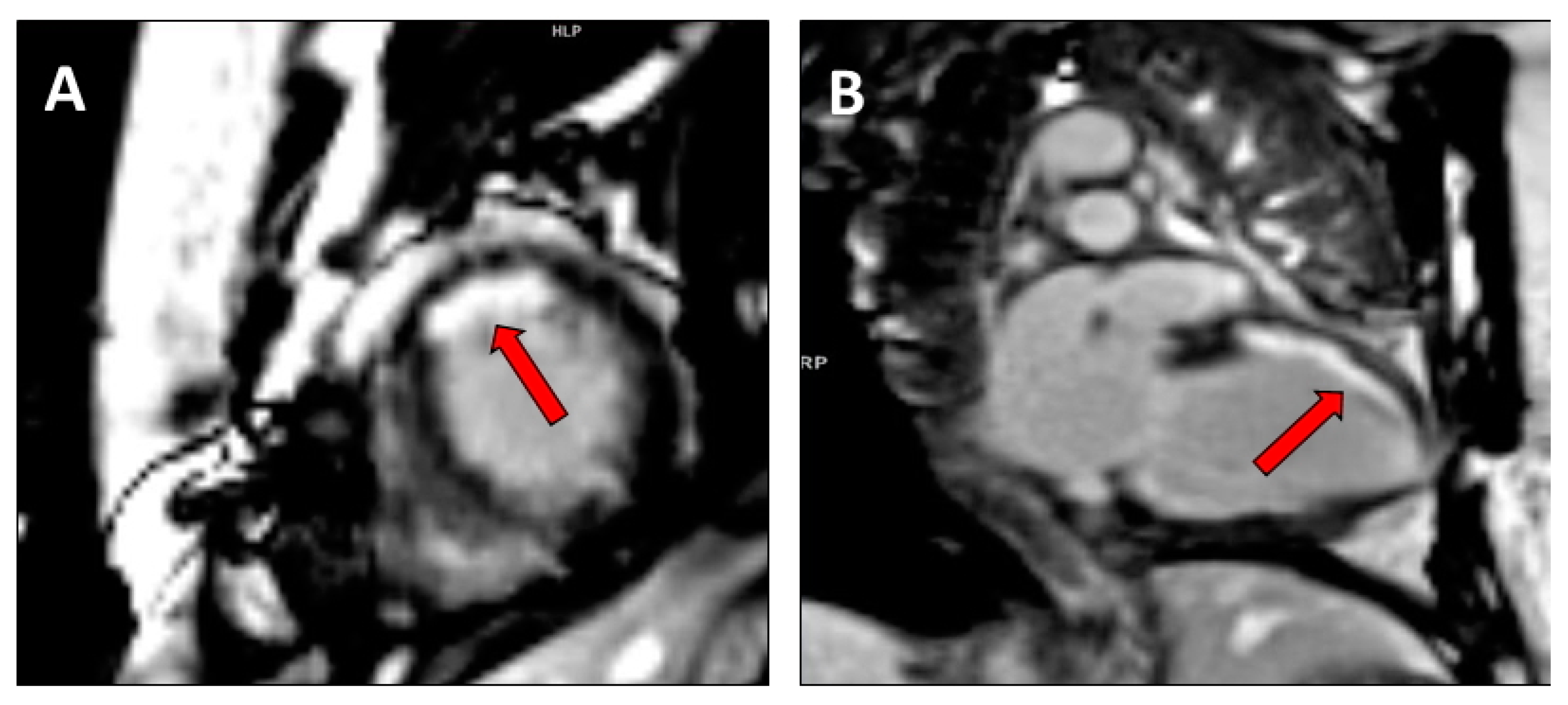 Hearts 01 00017 g004