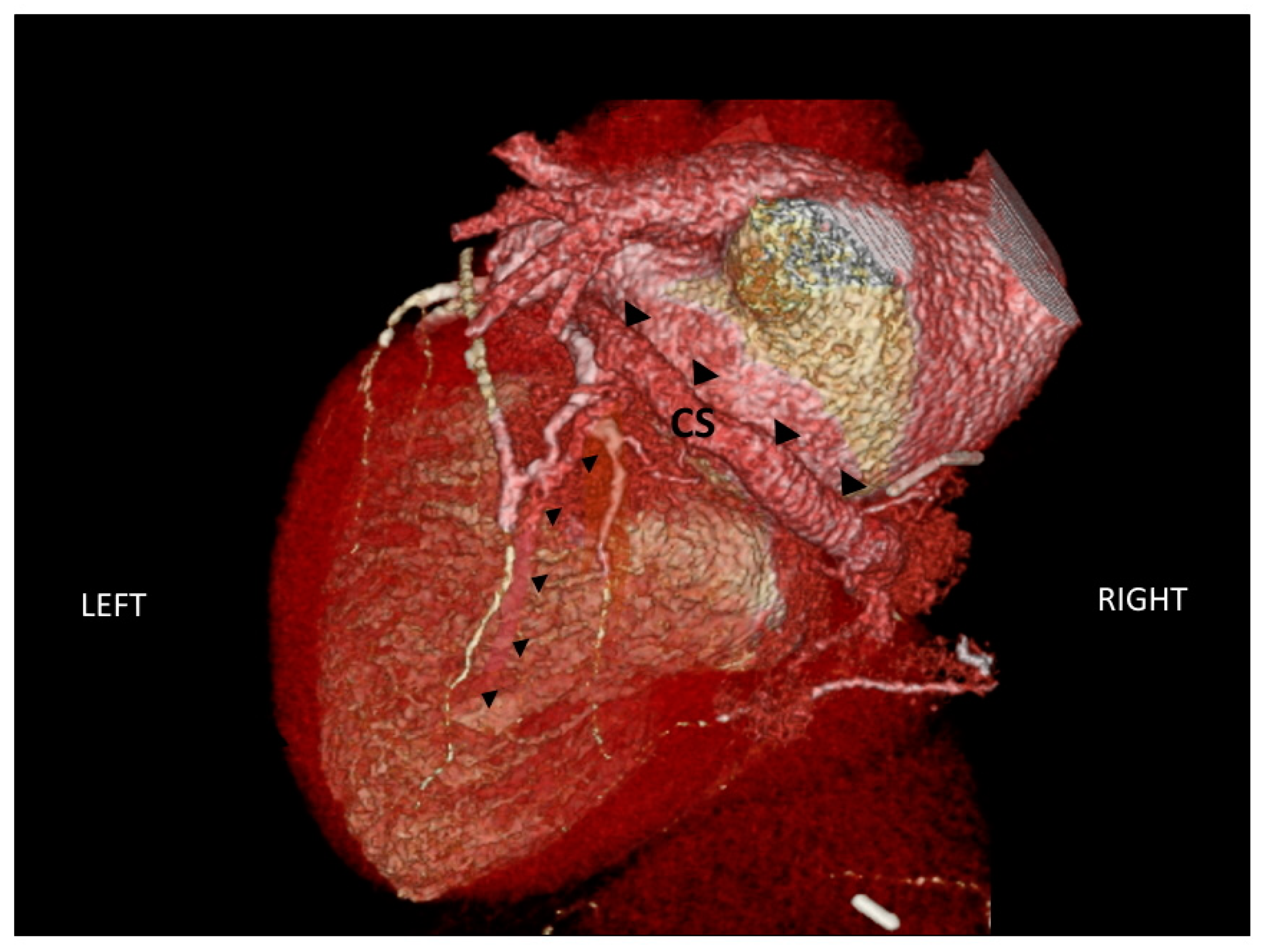 Hearts 01 00017 g005