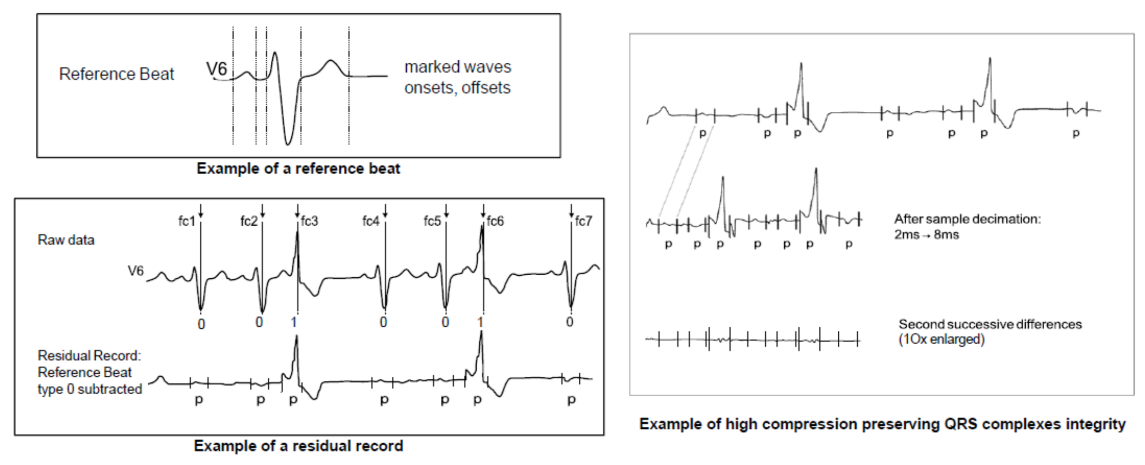 Hearts | Free Full-Text | The History and Challenges of SCP-ECG: The  Standard Communication Protocol for Computer-Assisted Electrocardiography |  HTML