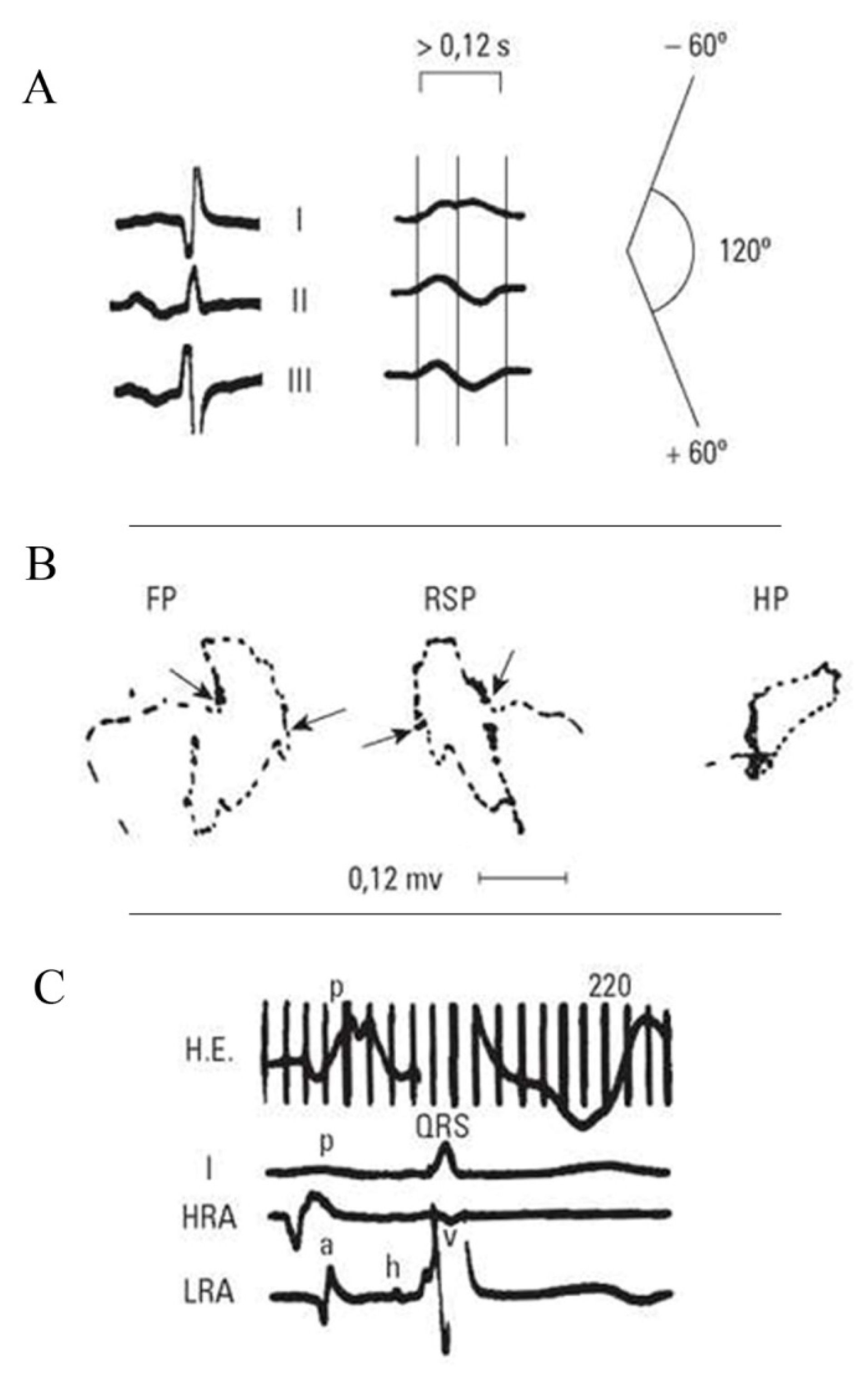 Hearts 02 00033 g005 Hearts 02 00033 g005