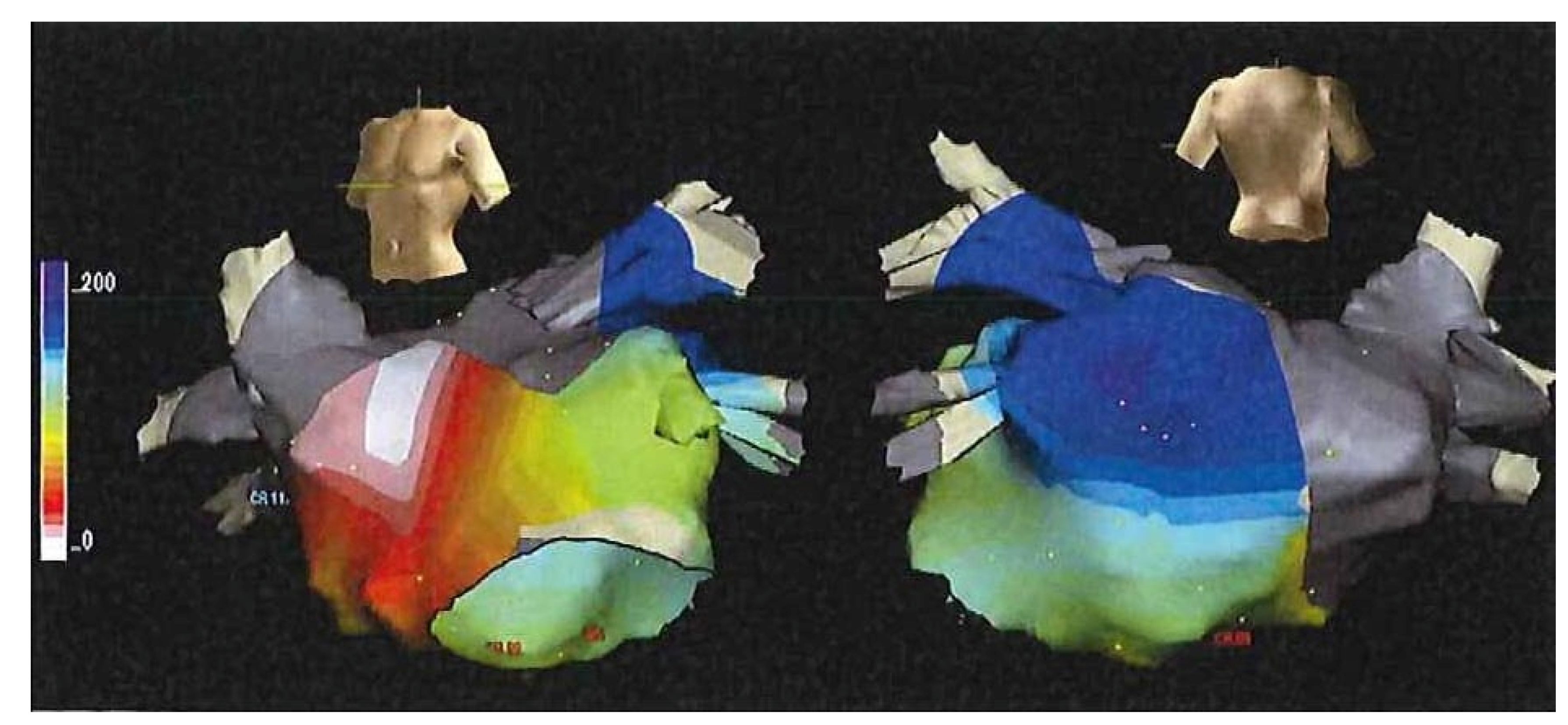 Hearts 02 00033 g006 Hearts 02 00033 g006