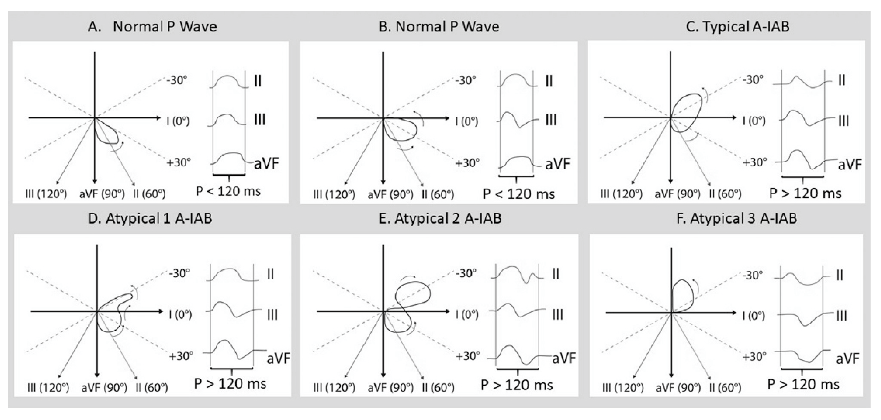 Hearts 02 00033 g009 Hearts 02 00033 g009