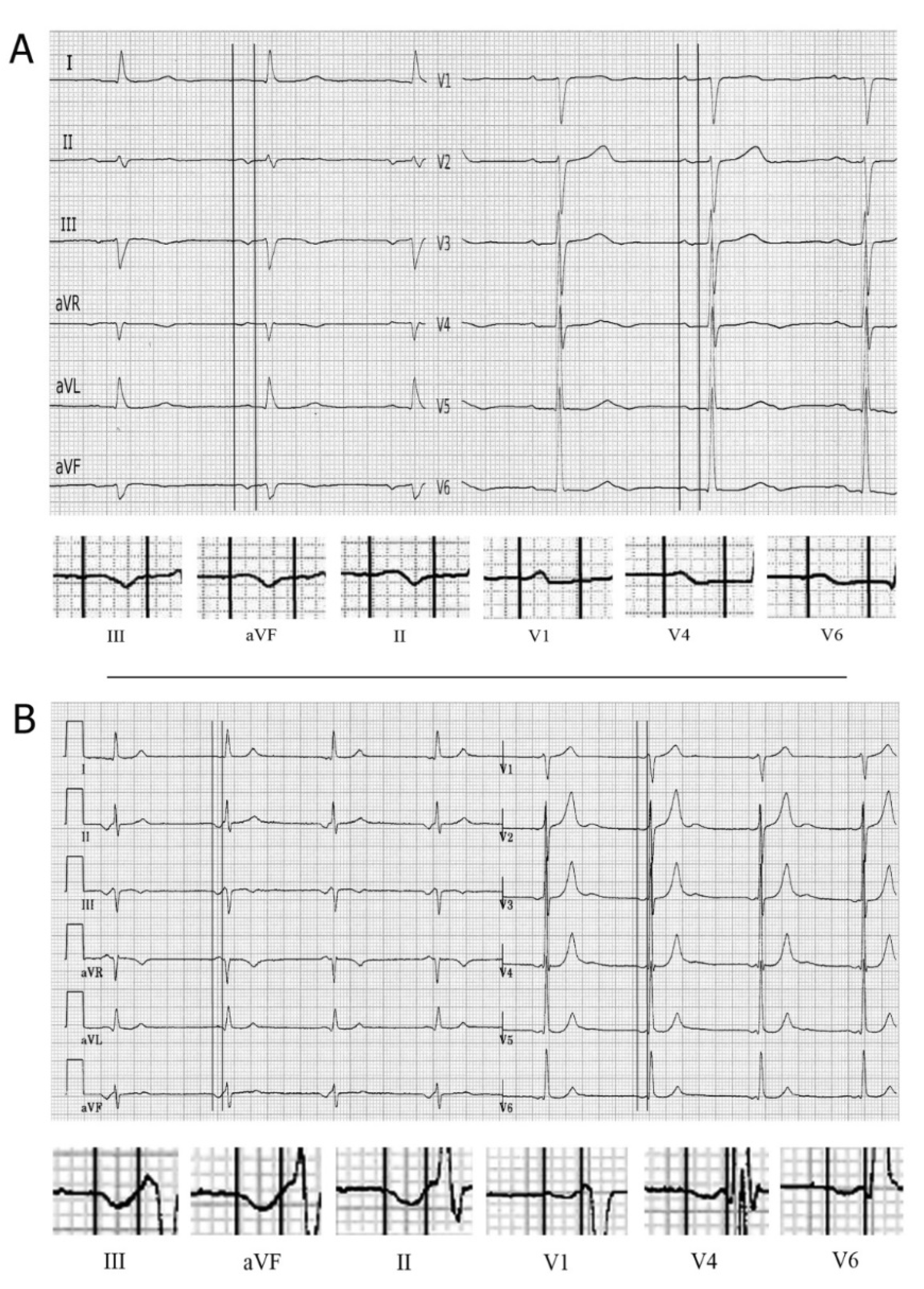 Hearts 02 00033 g010 Hearts 02 00033 g010