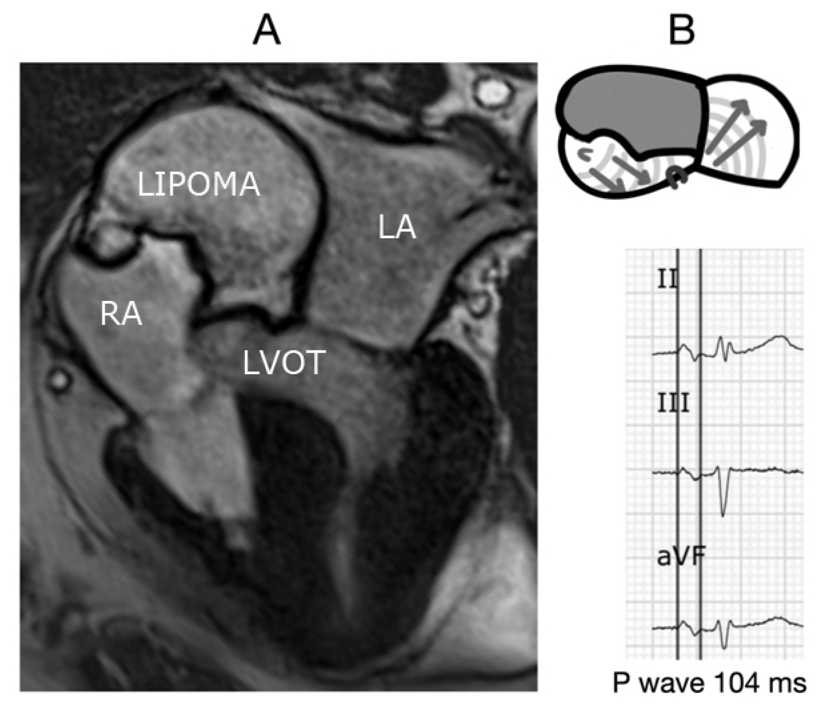 Hearts 02 00033 g011 Hearts 02 00033 g011