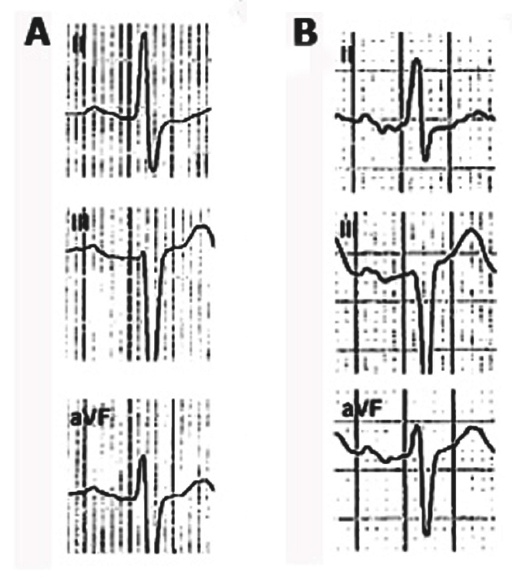 Hearts 02 00033 g013 Hearts 02 00033 g013