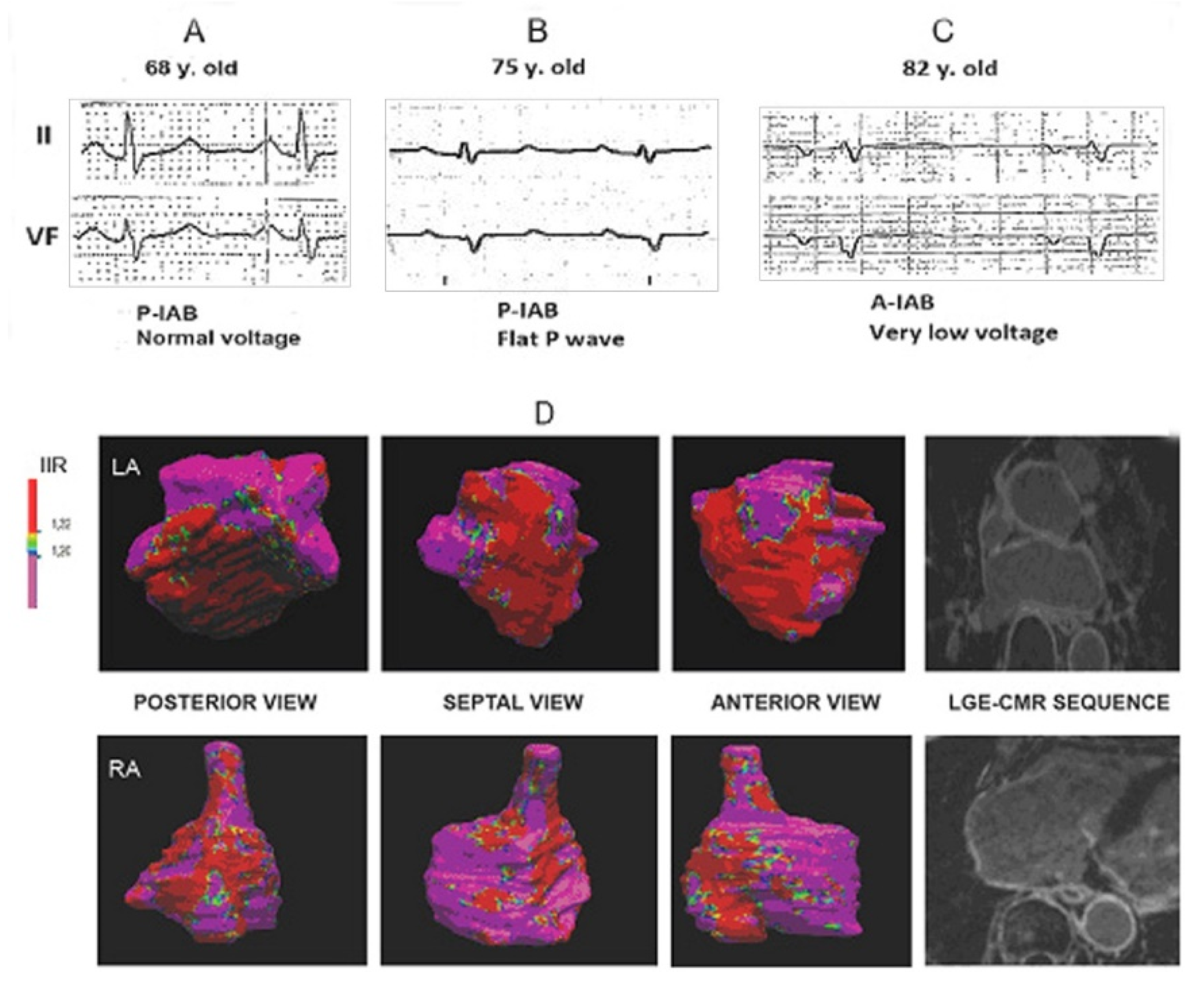 Hearts 02 00033 g014 Hearts 02 00033 g014