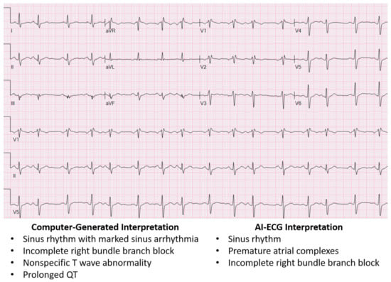 Hearts | Free Full-Text | ECG Interpretation: Clinical Relevance,  Challenges, and Advances