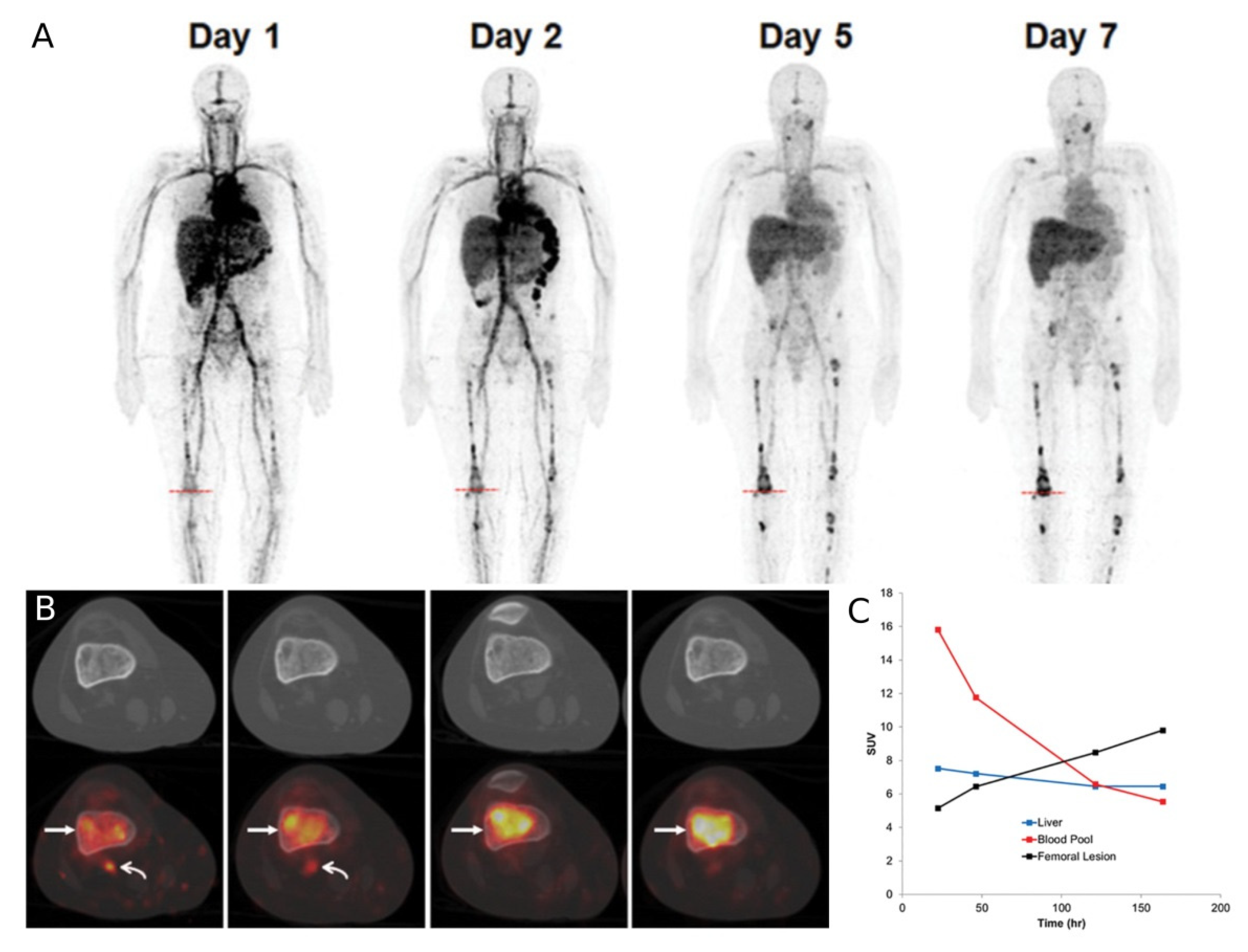 Hemato | Free Full-Text | New Targets for PET Imaging of Myeloma