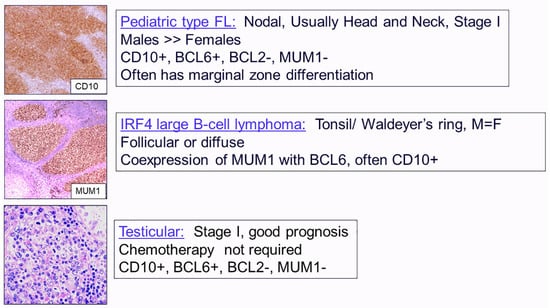 Hemato Free Full Text B And T Nk Cell Lymphomas In The 2022 International Consensus 