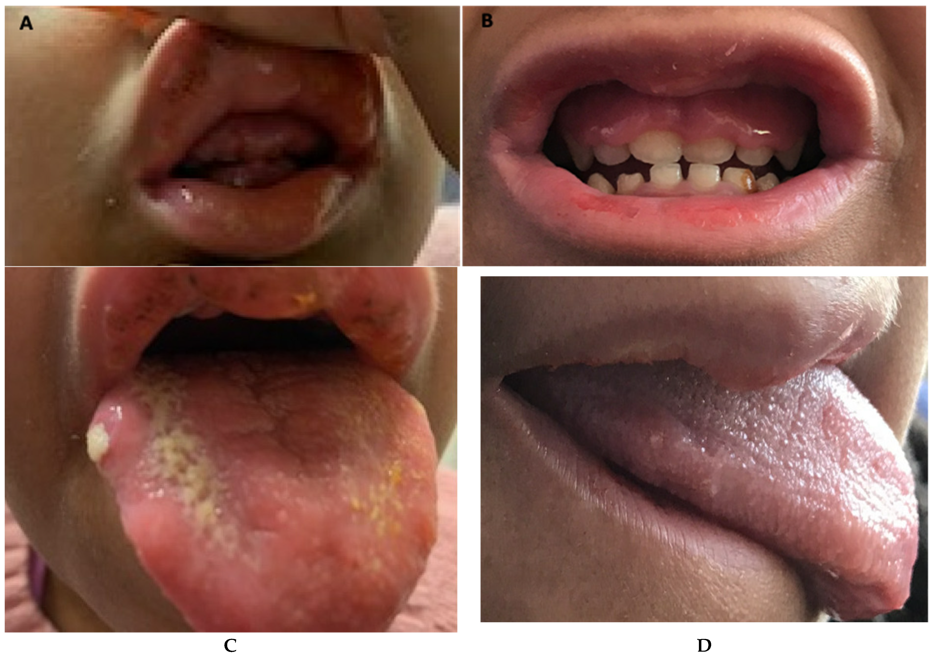 Hematolrep 14 00038 g002