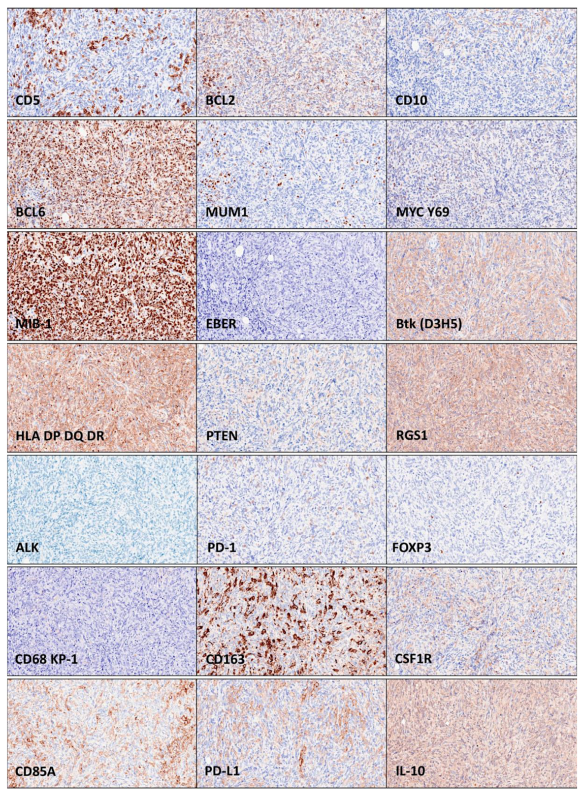 Hematolrep 15 00020 g002 Hematolrep 15 00020 g002