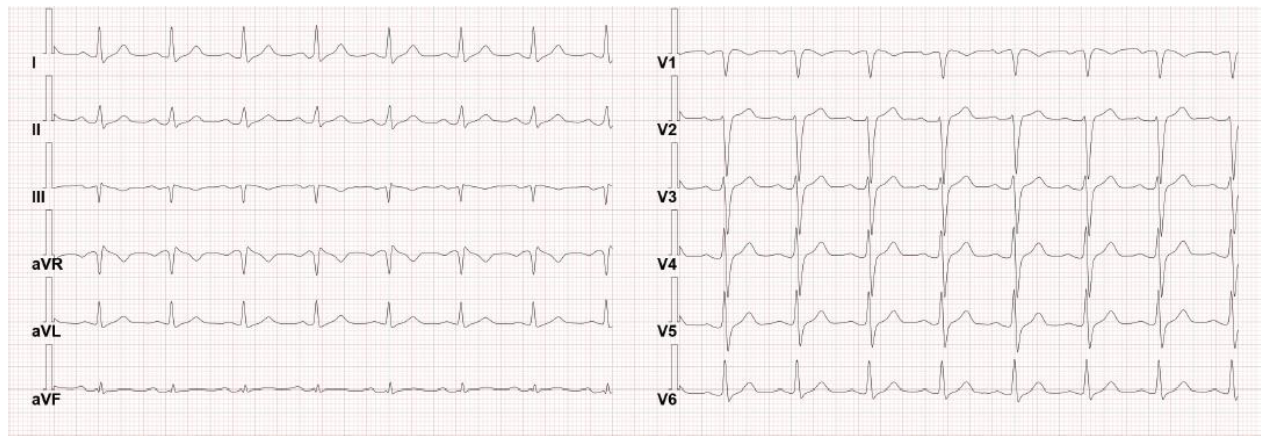 Hematolrep 15 00045 g001 Hematolrep 15 00045 g001