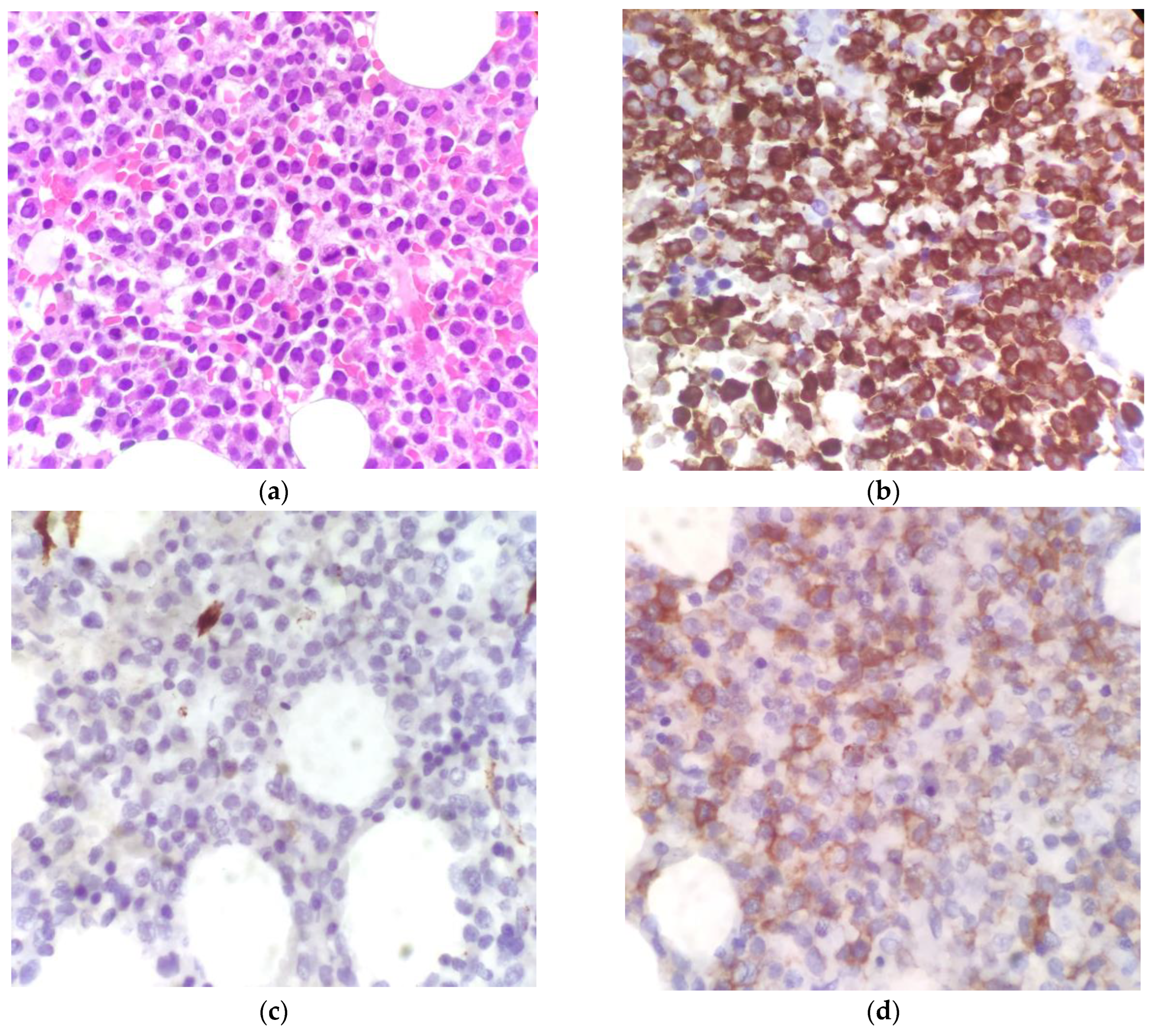 Hematolrep 15 00045 g002 Hematolrep 15 00045 g002