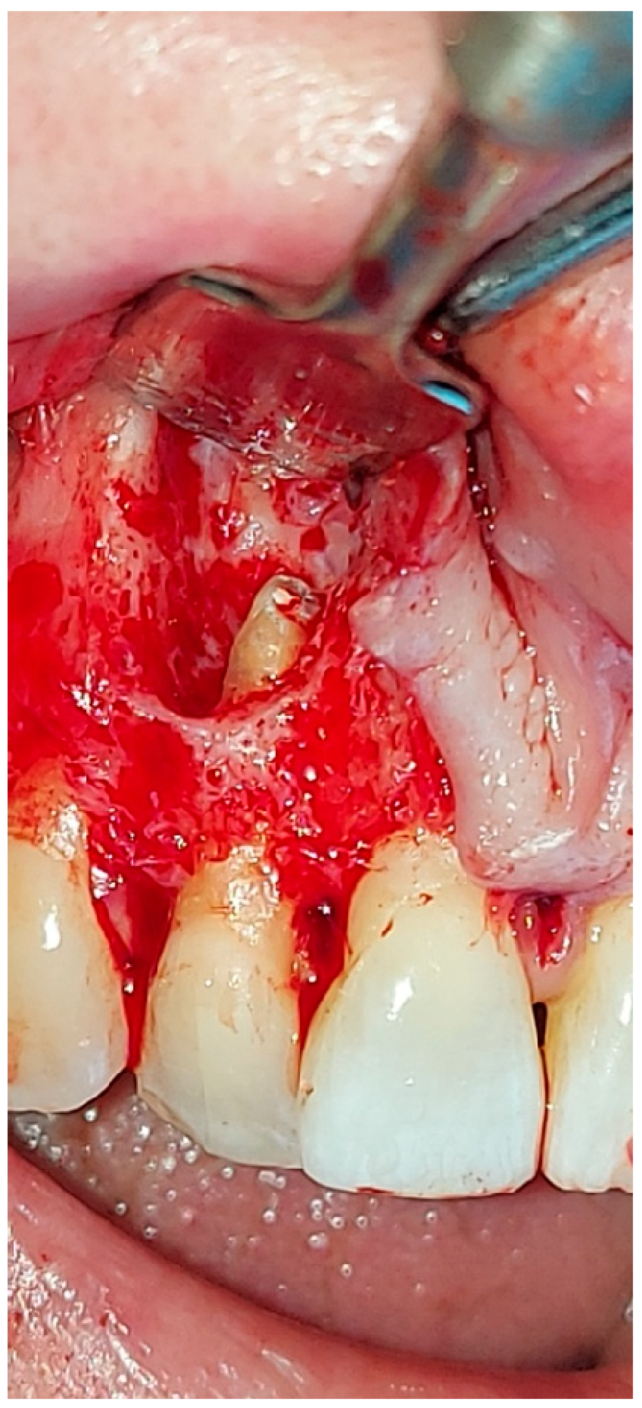 Hematolrep 16 00003 g007 Hematolrep 16 00003 g007