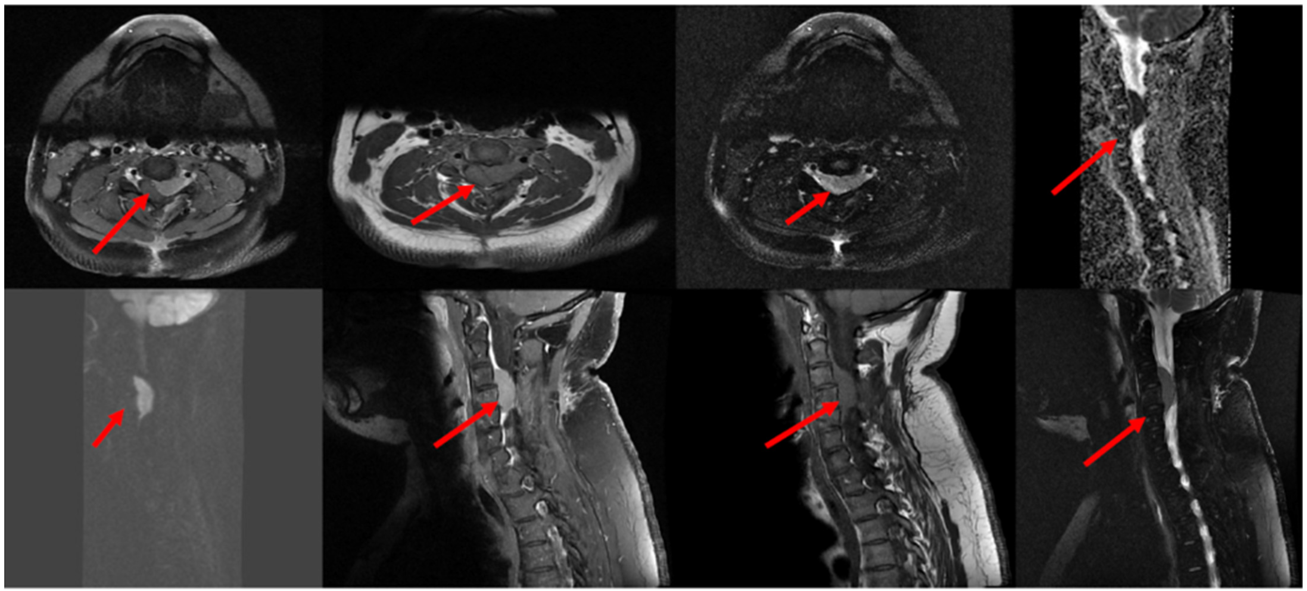 Hematolrep 16 00069 g001 Hematolrep 16 00069 g001