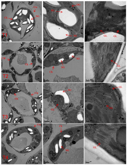 Ultra Structure of Chloroplast in Algae : Plantlet