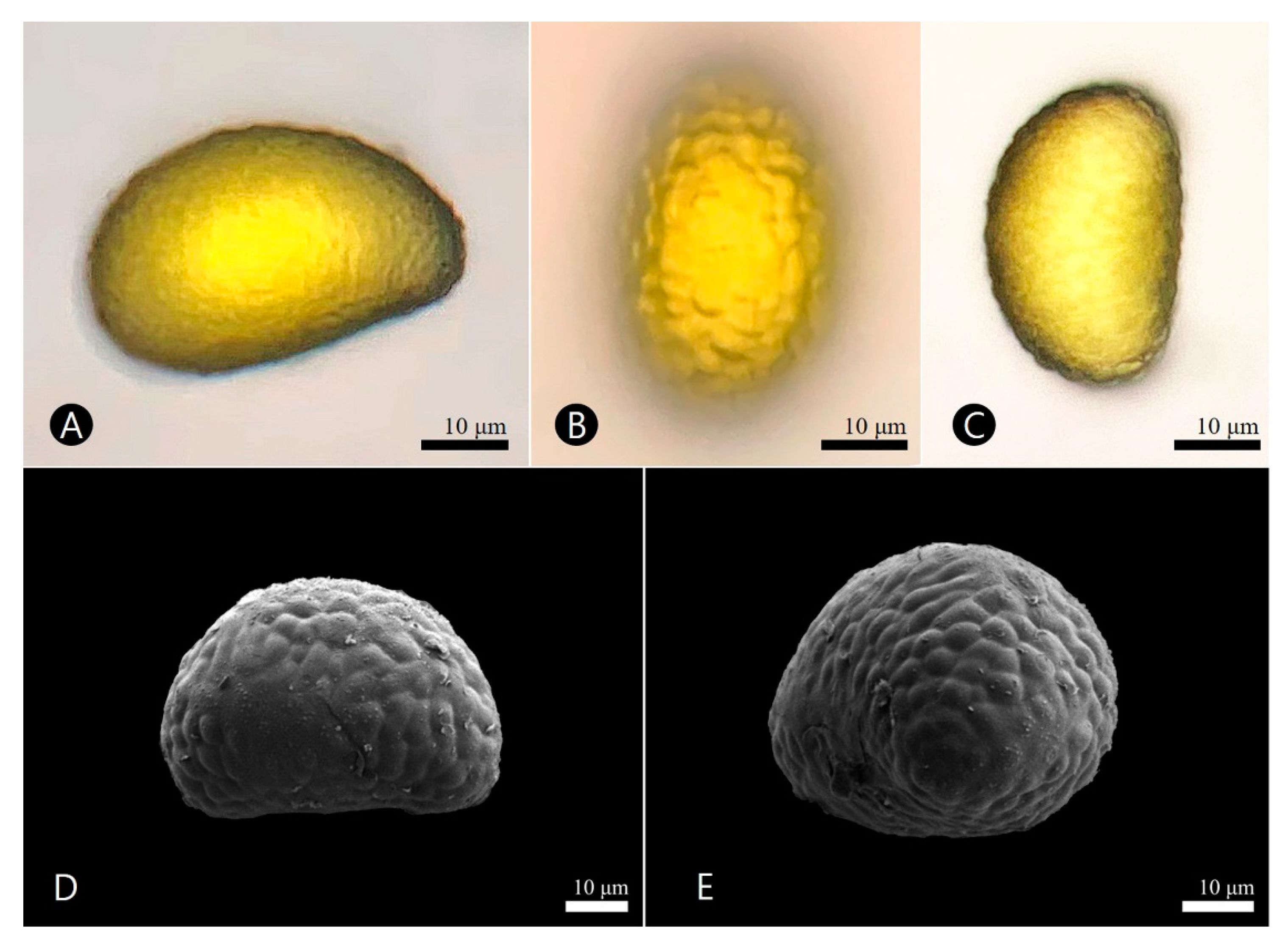 PDF) Spore morphology and ultrastructure of Dennstaedtiaceae from