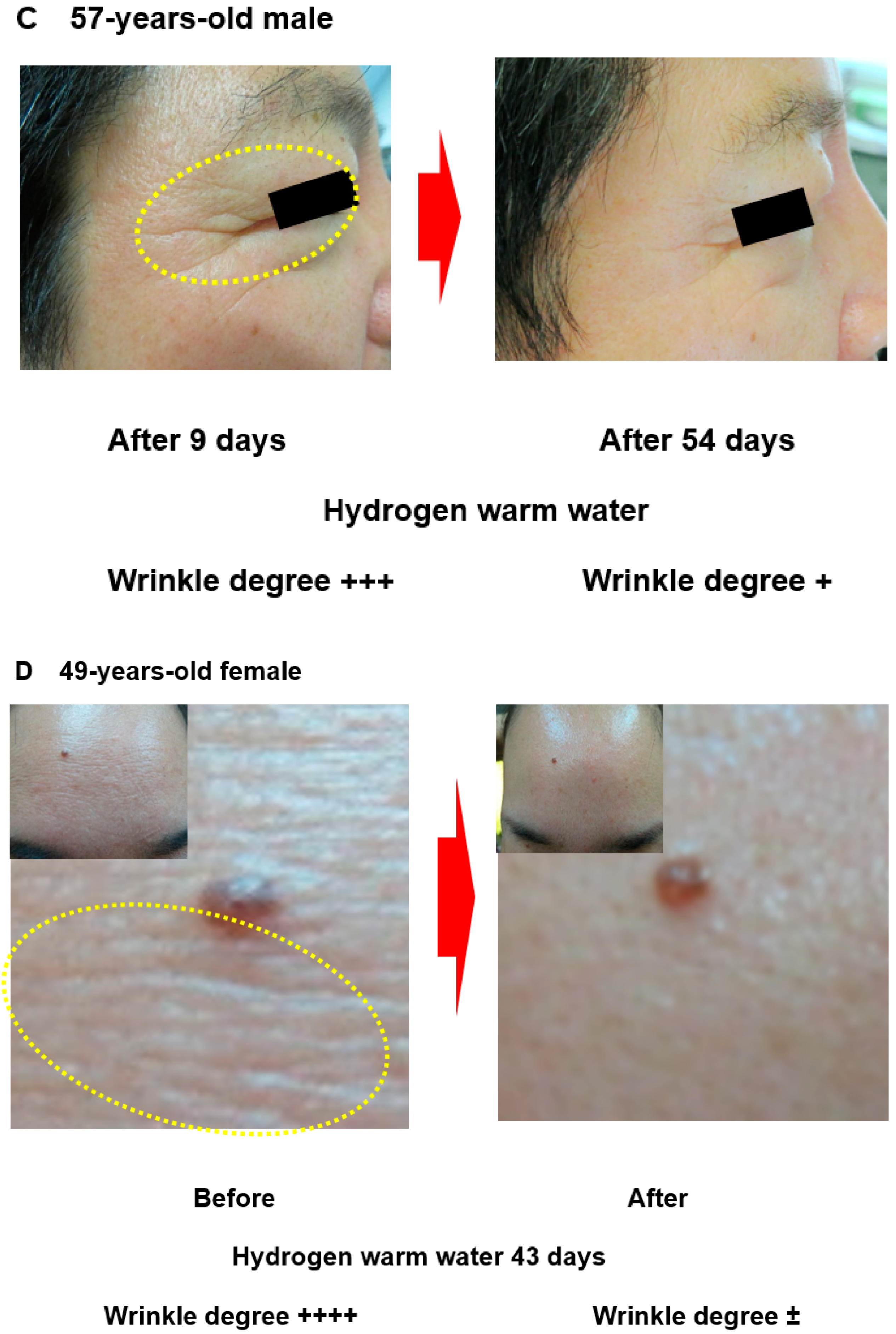 Hydrogen 03 00011 g001b