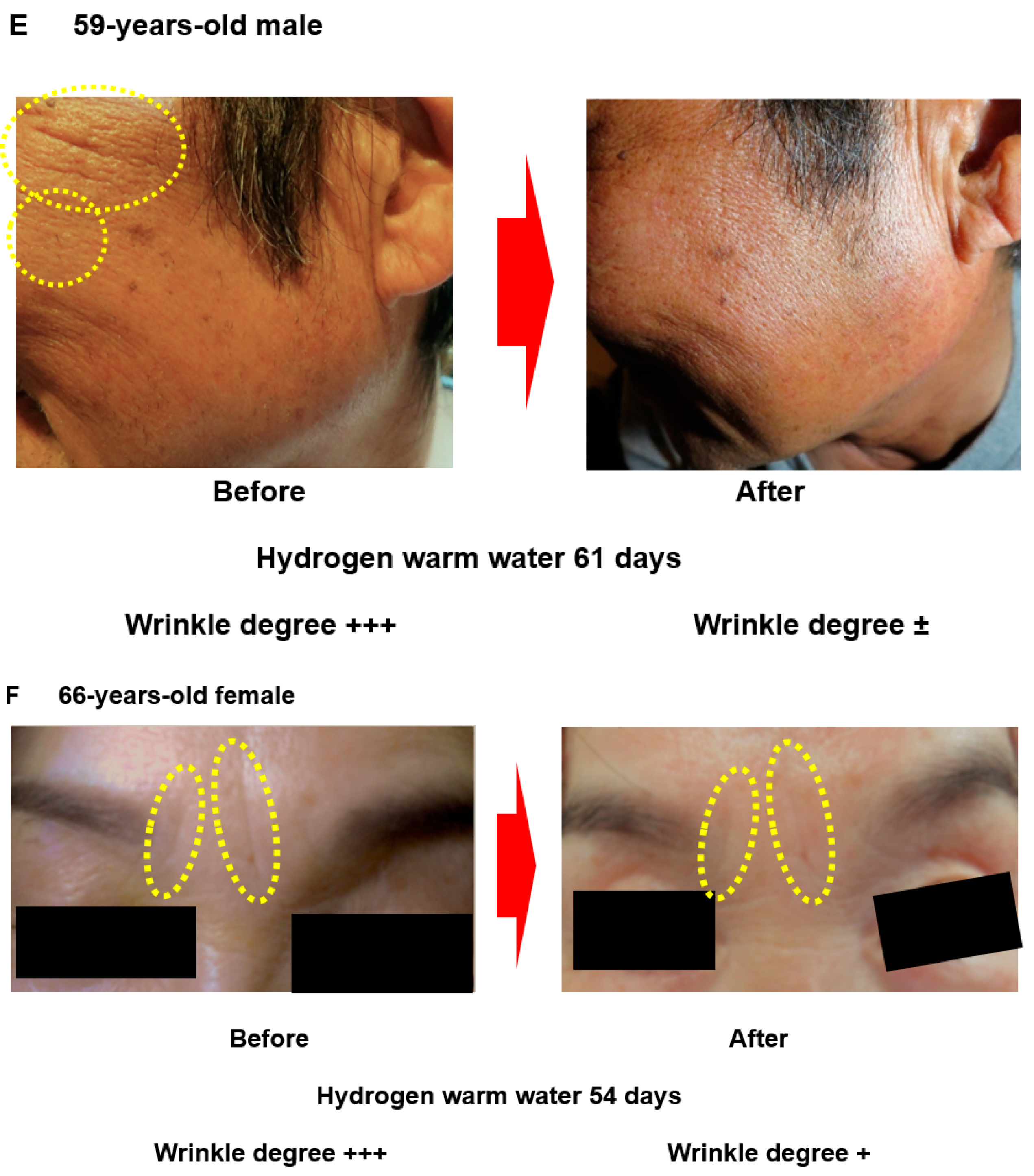 Hydrogen 03 00011 g001c