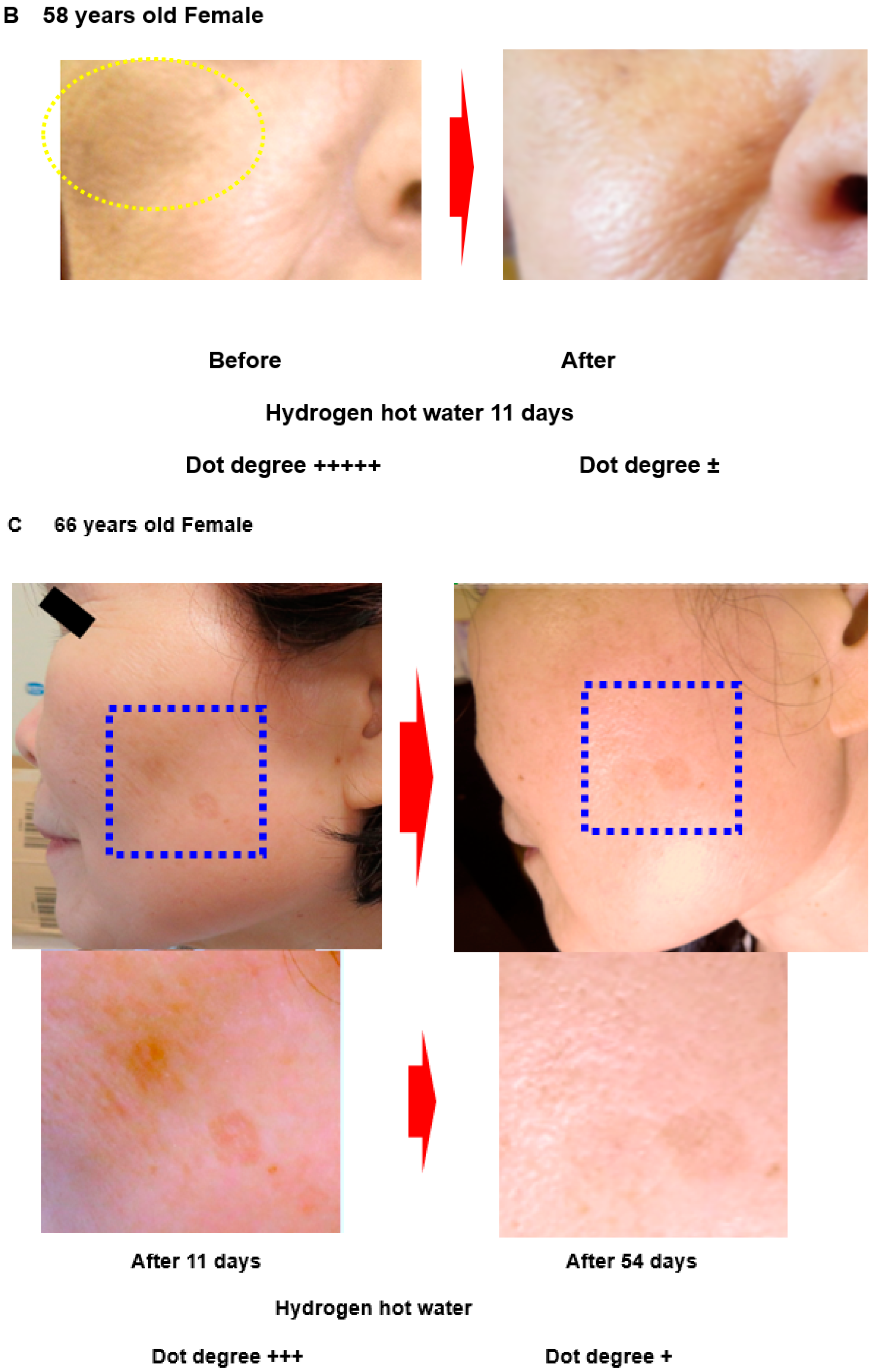 Hydrogen 03 00011 g003b