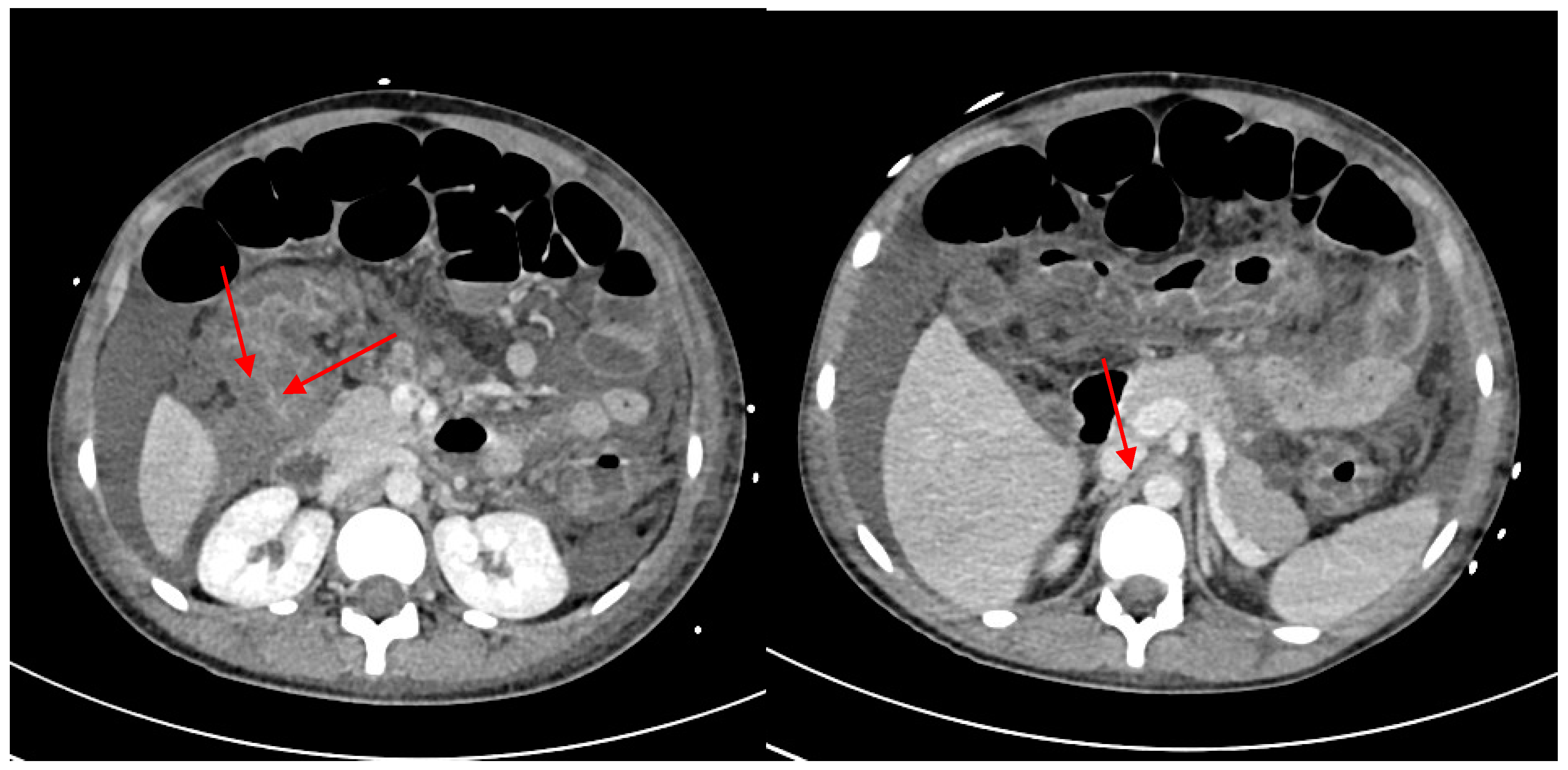 Idr 15 00038 g004 Idr 15 00038 g004