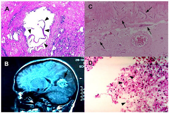 Infectious Disease Reports Free Full Text Emerging and Re