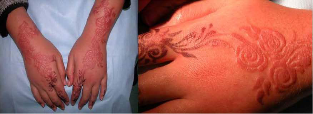 Calls in Oman to shun use of black henna during Eid-Al-Fitr - Times of Oman