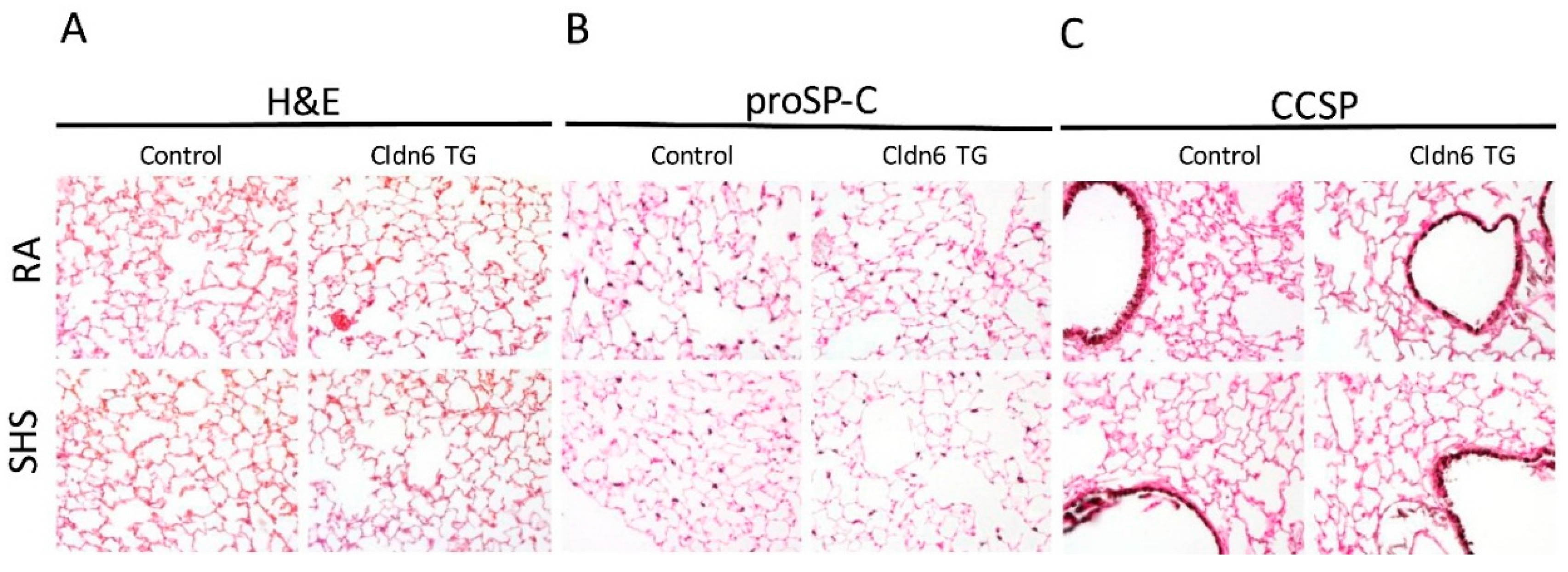 Ijerph Free Full Text Up Regulation Of Claudin 6 In The Distal Lung Impacts Secondhand Smoke 