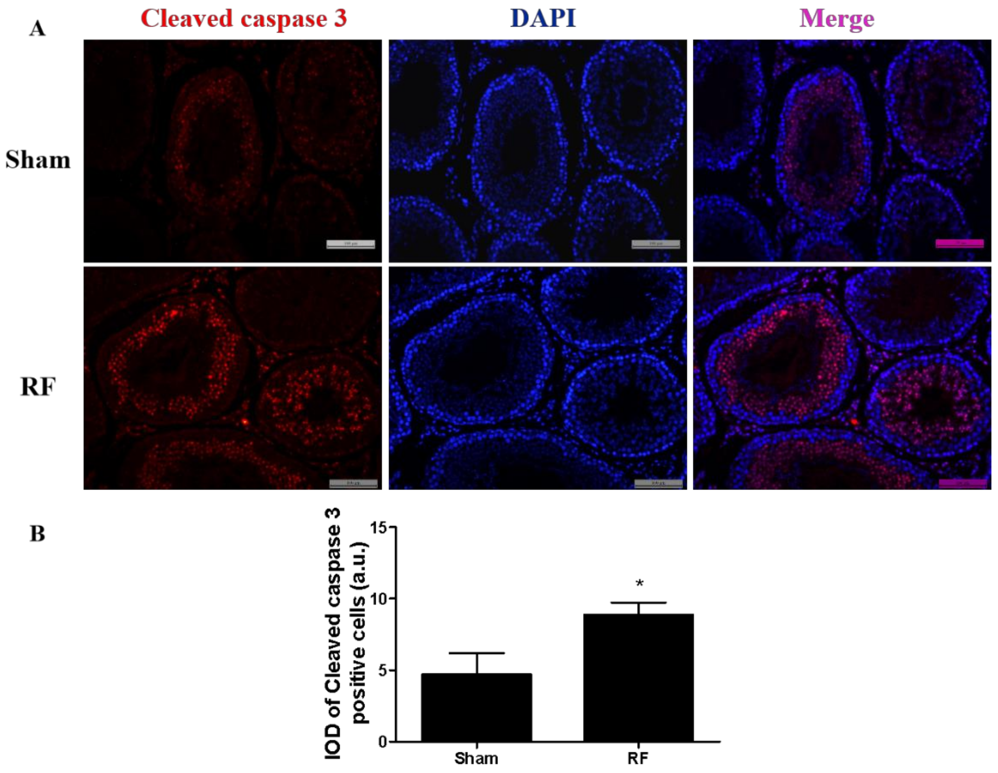 Ijerph Free Full Text Effects Of 2 Mhz Pulsed Modulated Radiofrequency Field On The Sperm Quality In Rats Html