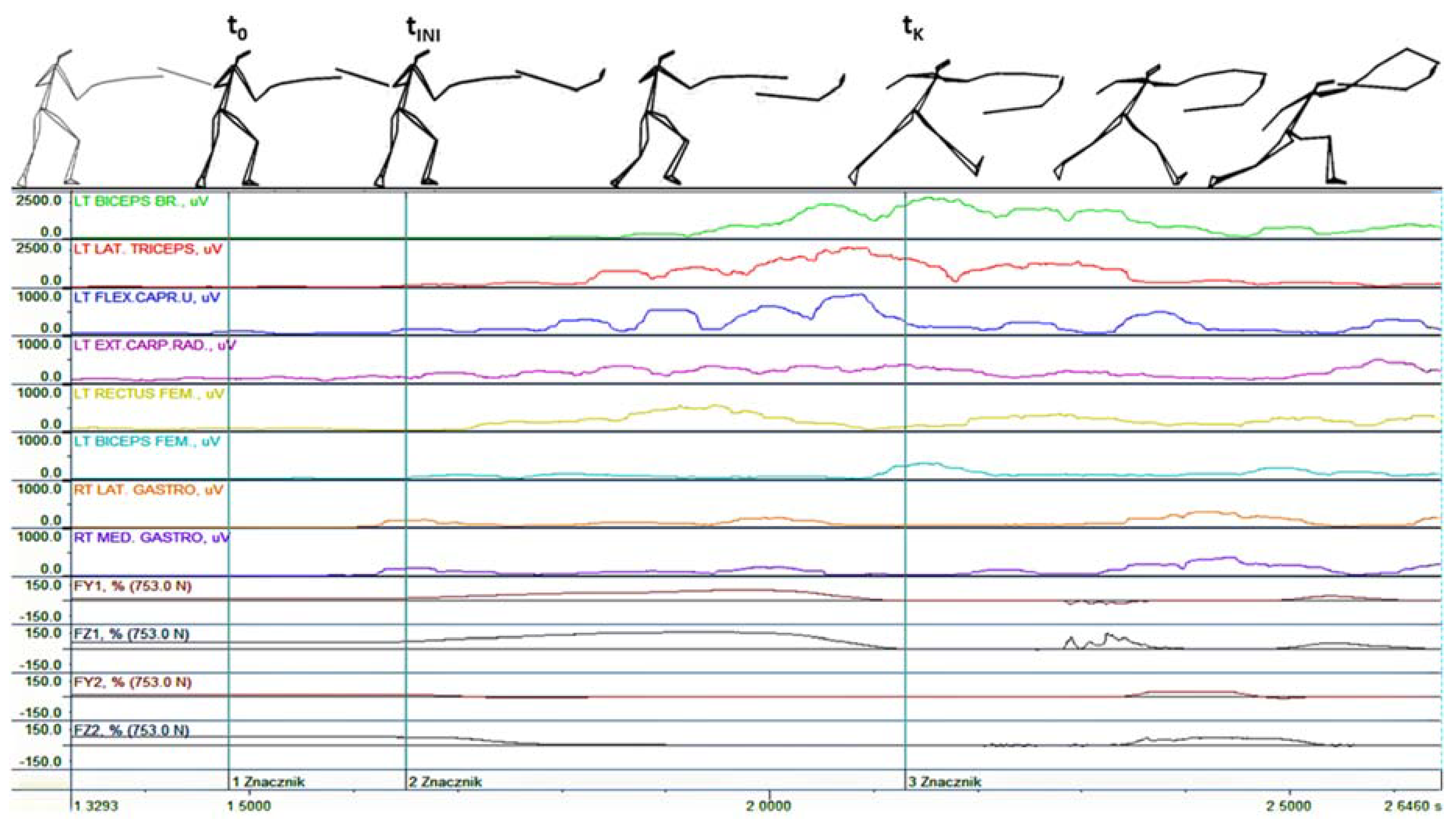 IJERPH | Free Full-Text | Flèche versus Lunge as the Optimal Footwork  Technique in Fencing