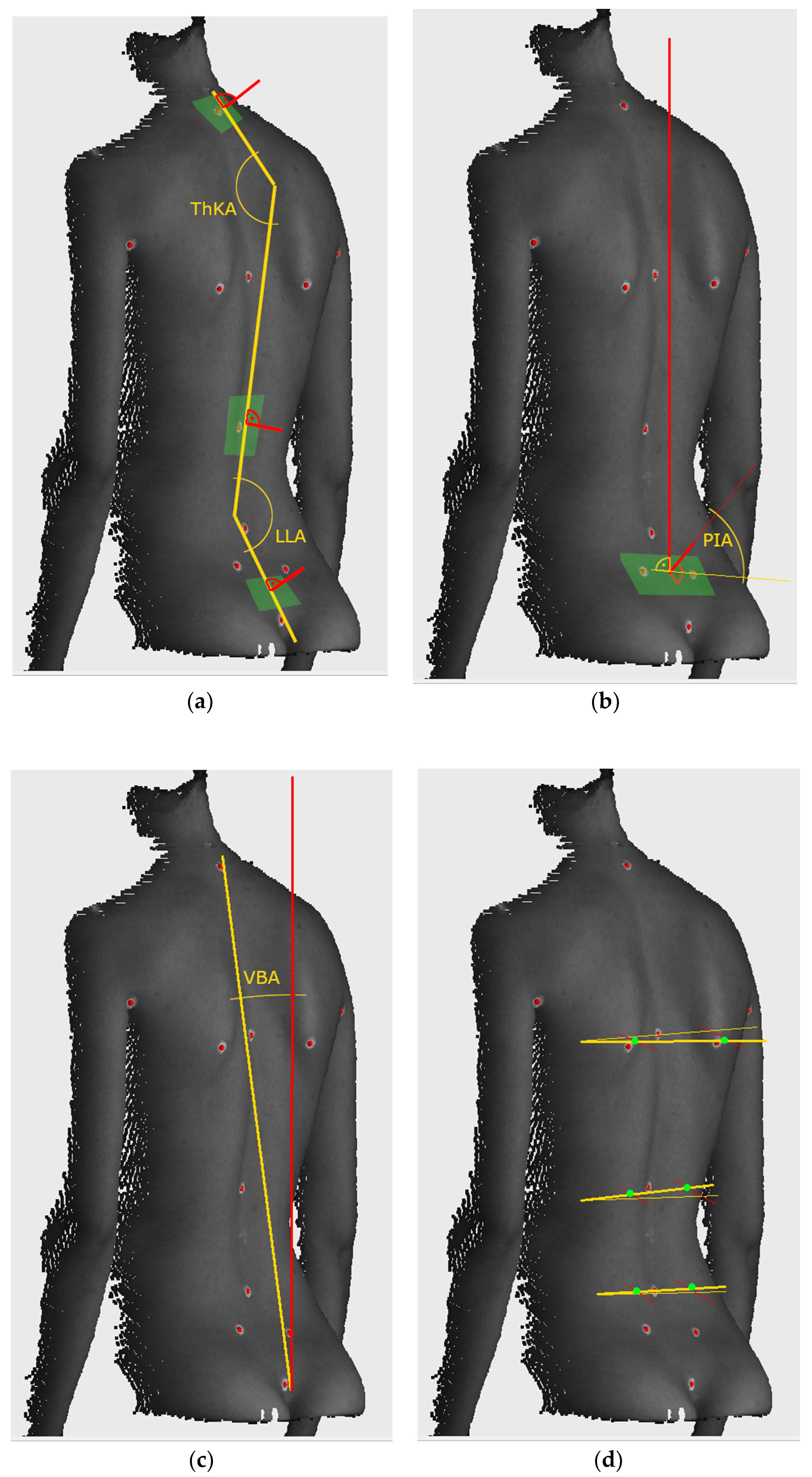 IJERPH | Free Full-Text | Decreased Vertical Trunk Inclination Angle and  Pelvic Inclination as the Result of Mid-High-Heeled Footwear on Static  Posture Parameters in Asymptomatic Young Adult Women | HTML