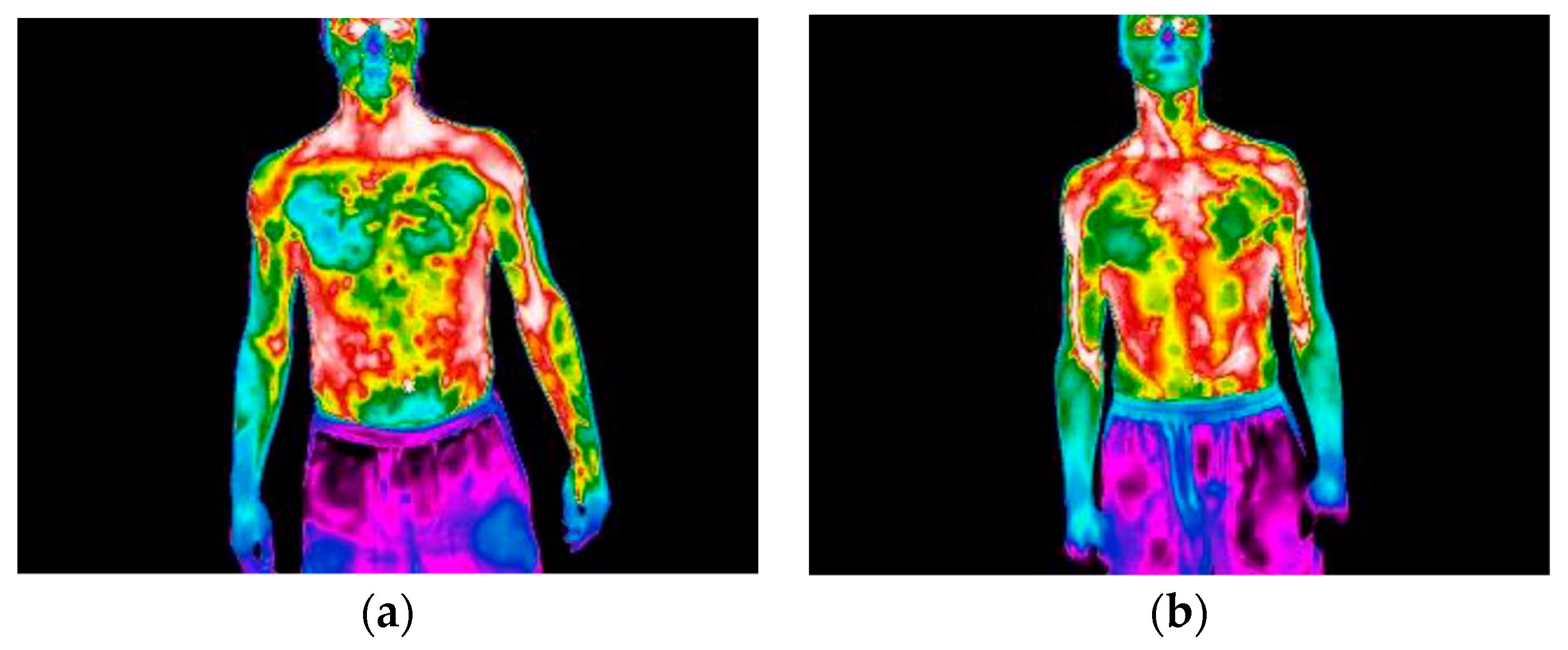 IJERPH | Free Full-Text | Hand-Arm Vibration Assessment and Changes in the  Thermal Map of the Skin in Tennis Athletes during the Service