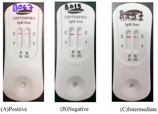 PHO: Negros leptospirosis, dengue, cholera deaths 27 - Digicast Negros