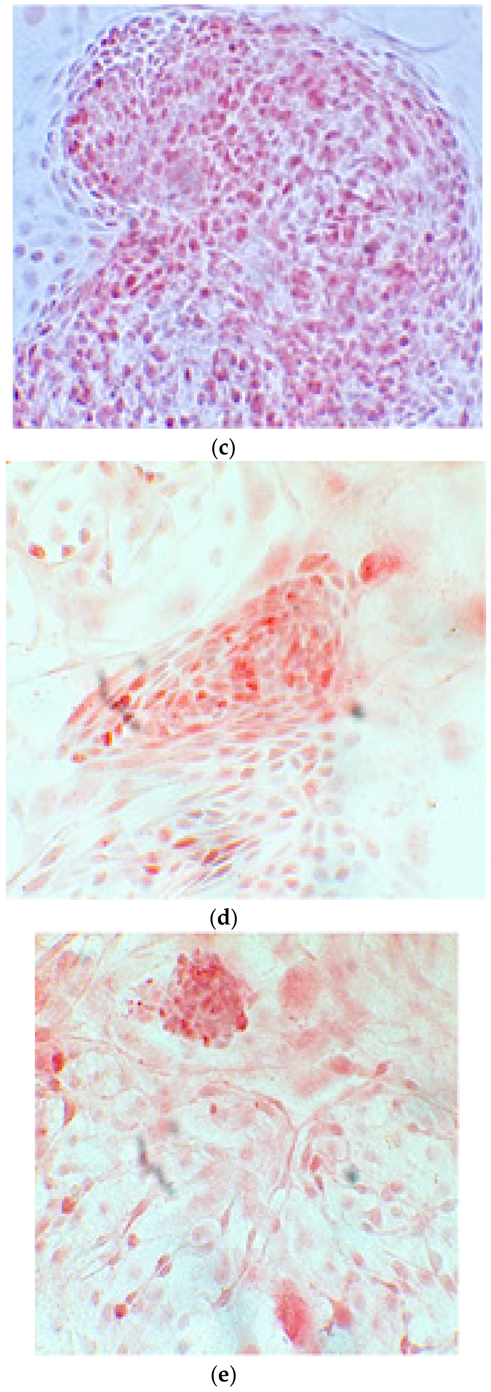 Ijerph 17 01947 g006b