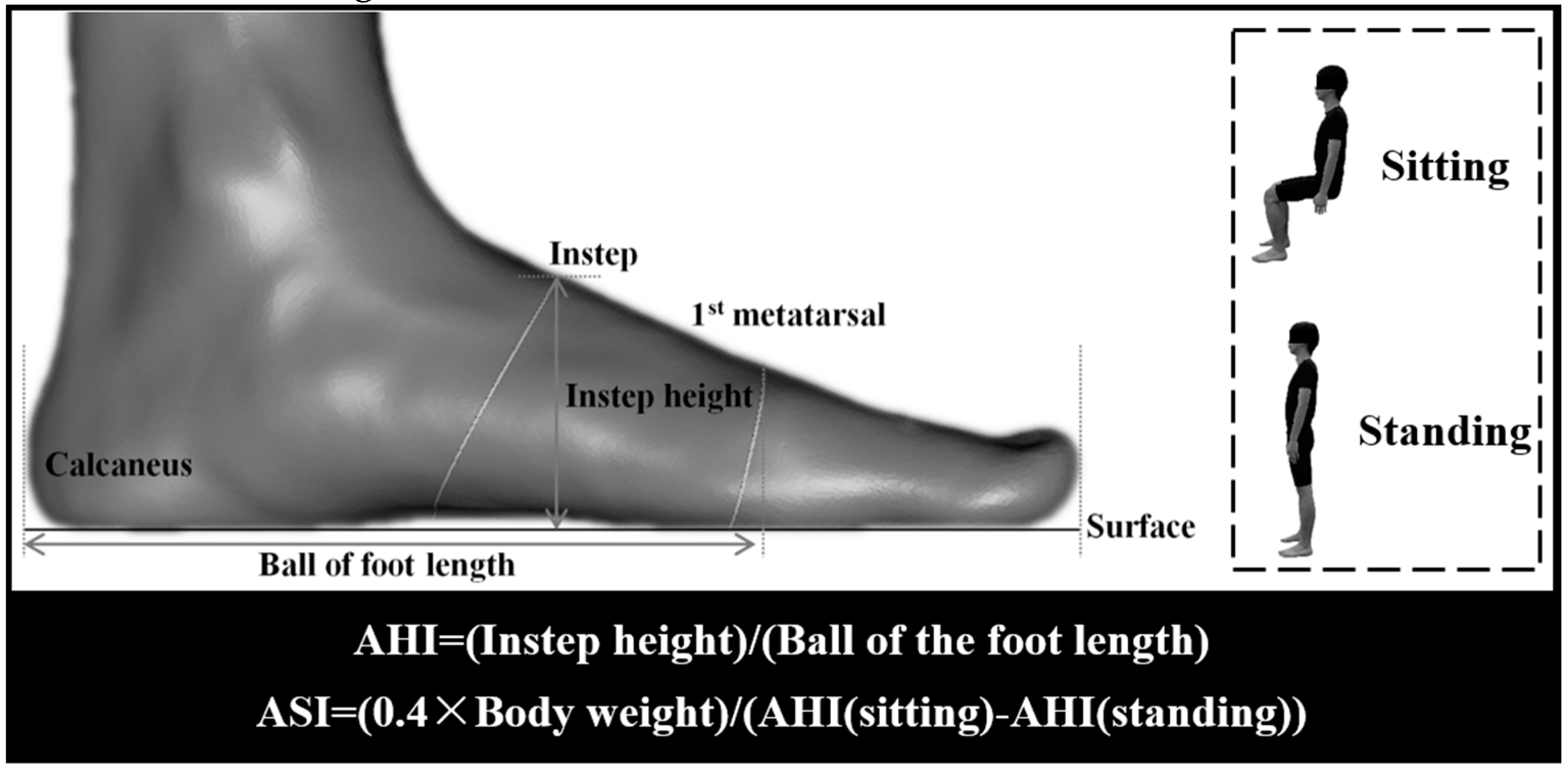 Ijerph Free Full Text Association Of Arch Stiffness With Plantar Impulse Distribution During Walking Running And Gait Termination Html