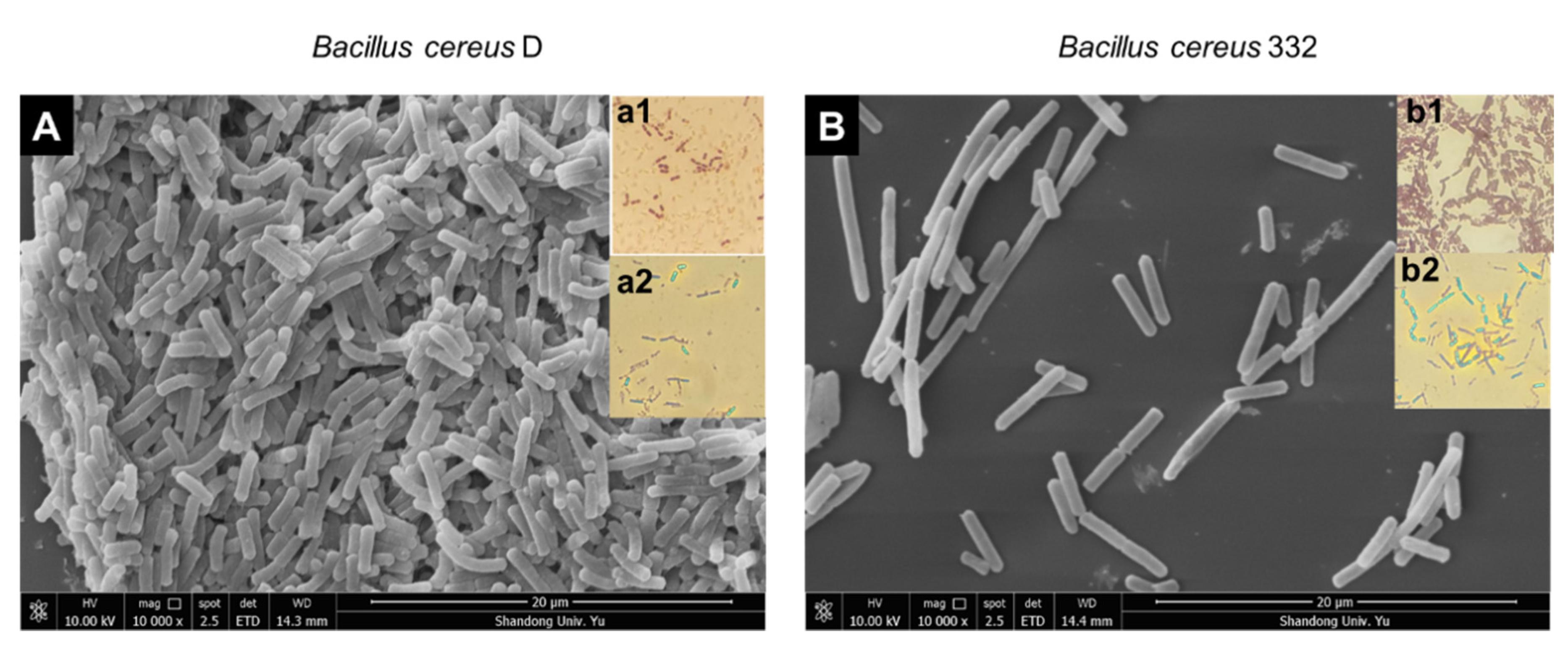 bacillus cereus gram stain