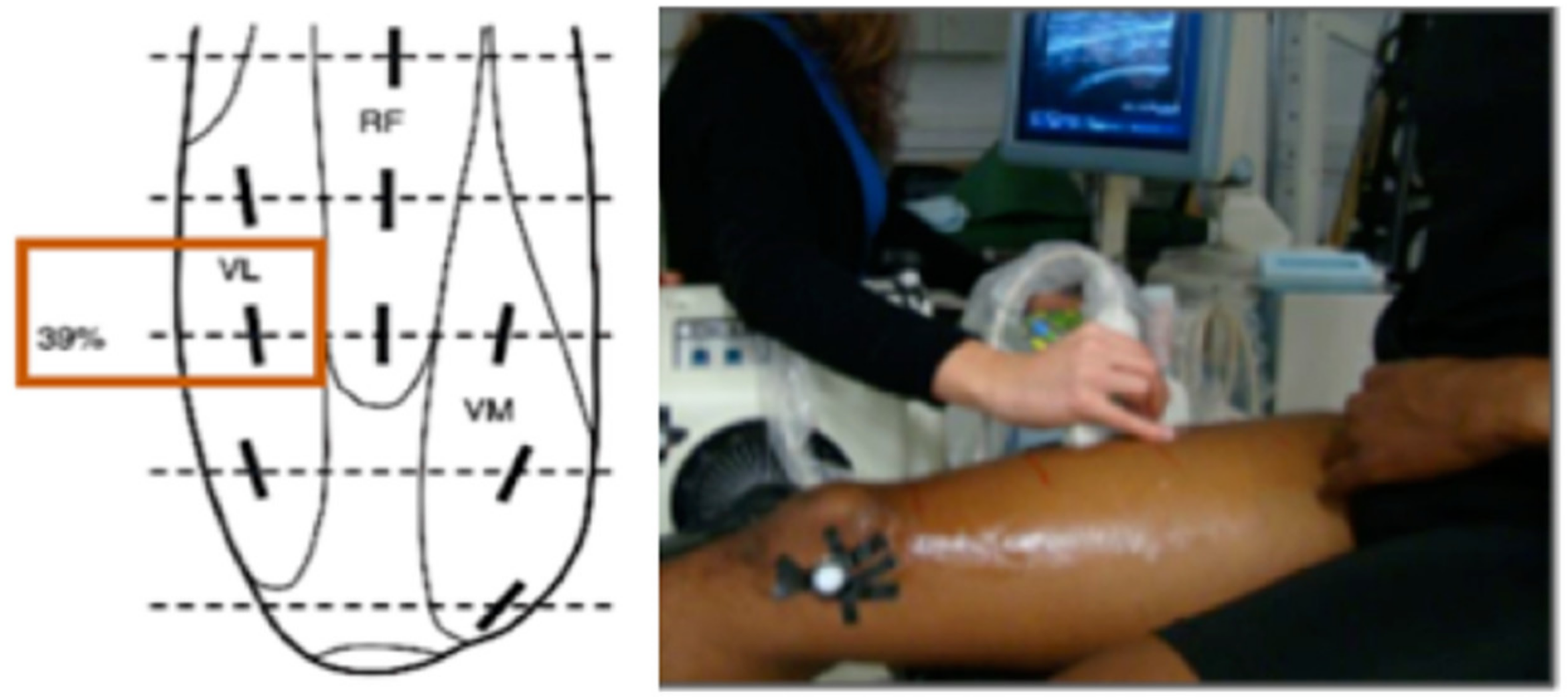 Body Proportions - Musculoskeletal Pain - Sports Performance - Damien  Howell PT