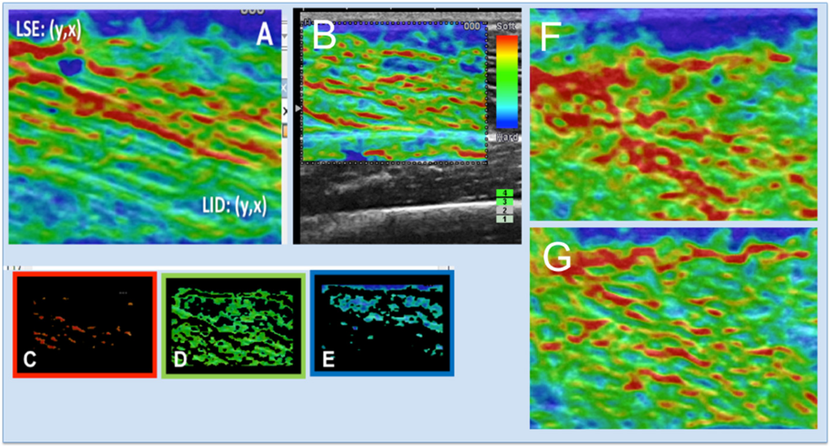 Ijerph 17 04381 g003