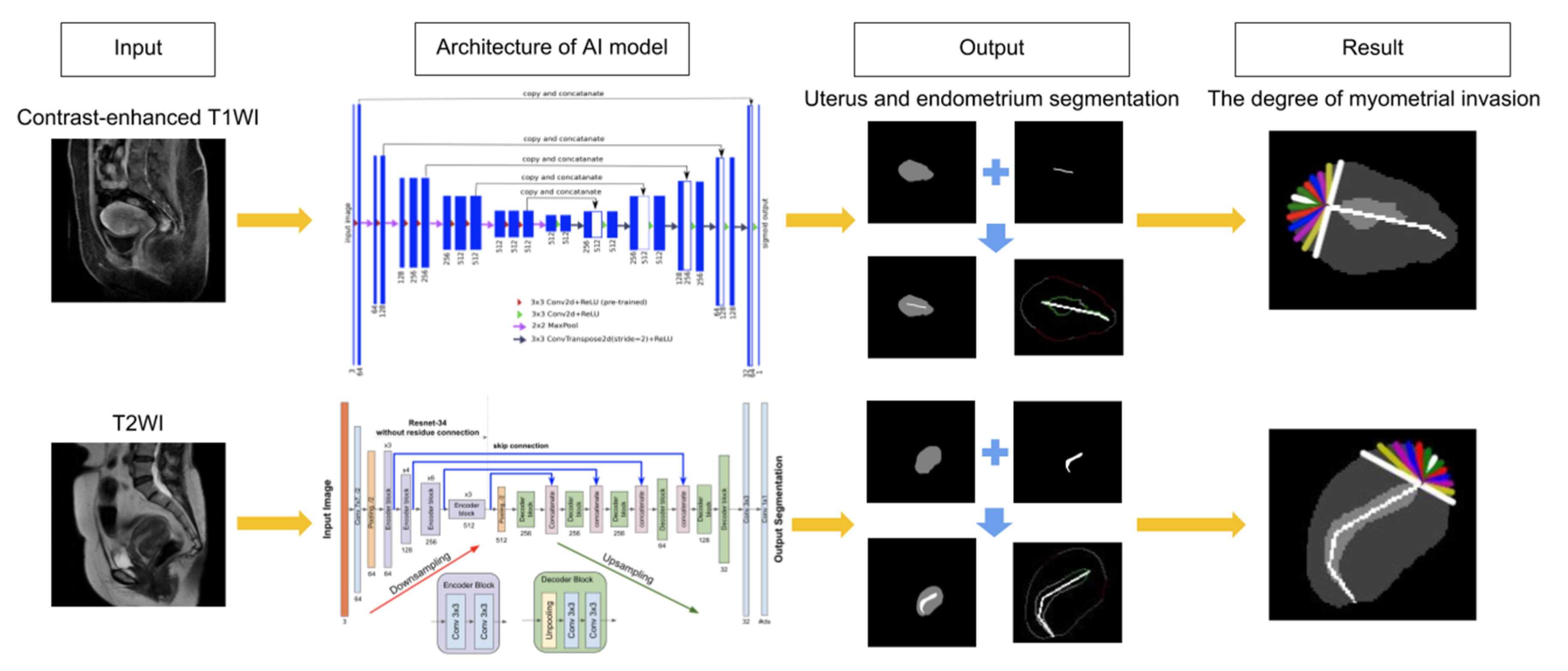 Ijerph Free Full Text Using Deep Learning With Convolutional Neural Network Approach To Identify The Invasion Depth Of Endometrial Cancer In Myometrium Using Mr Images A Pilot Study Html